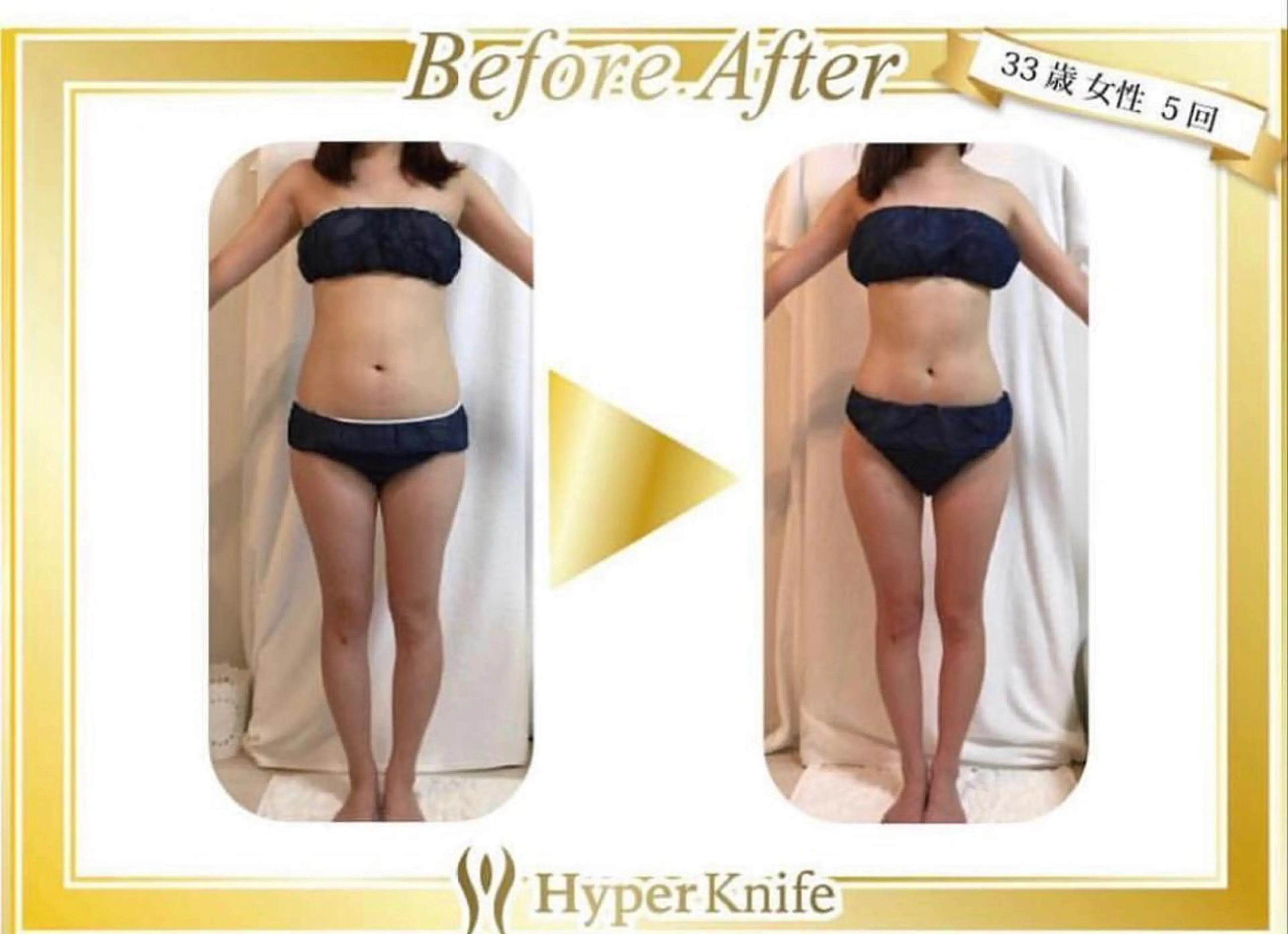 ワックス脱毛 ♡AYO♡のエステ・リラクイメージ