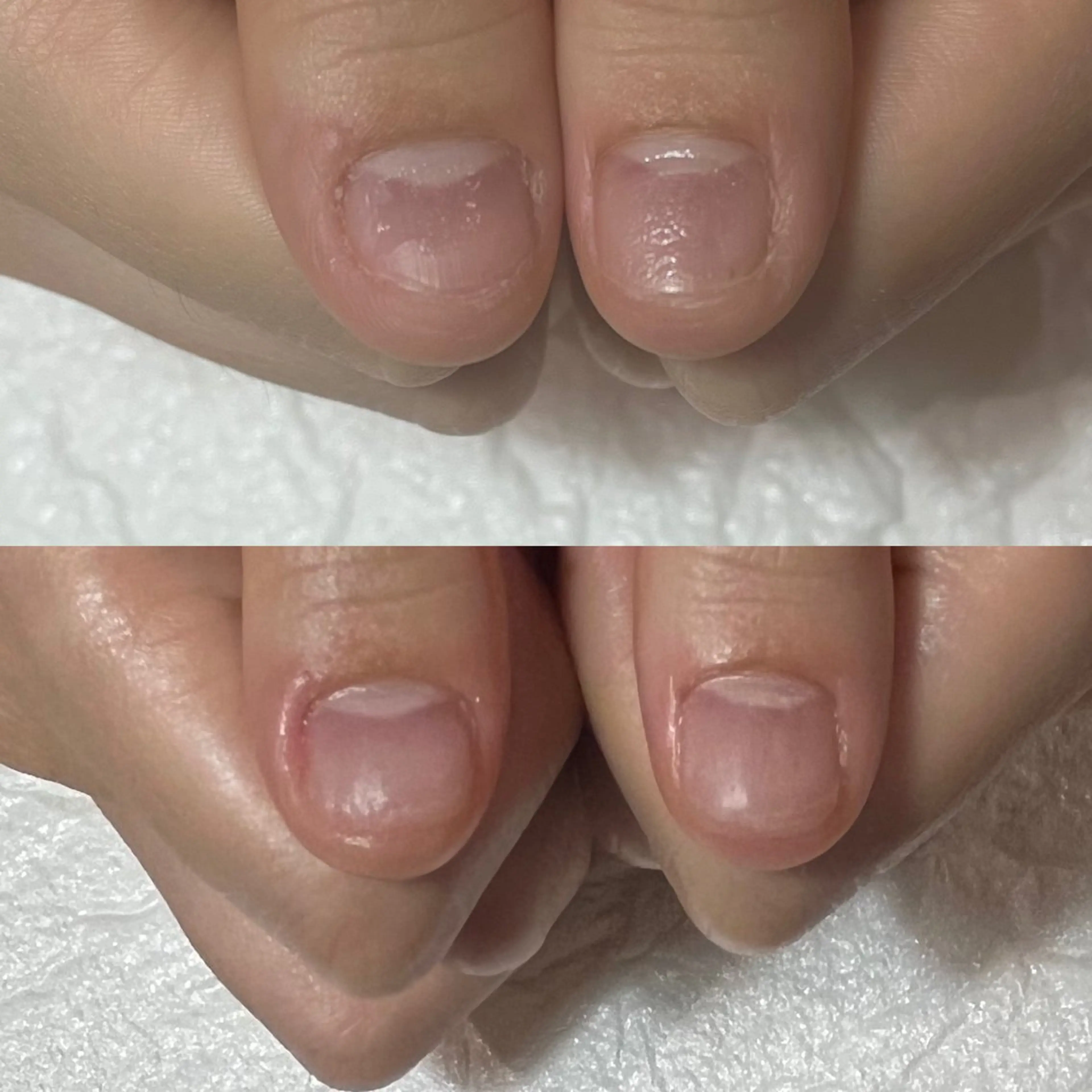 ネイル アートネイル クリアネイル ジェルネイル パラジェル 自爪育成・巻き爪 補正講師　津蔵のネイルデザイン