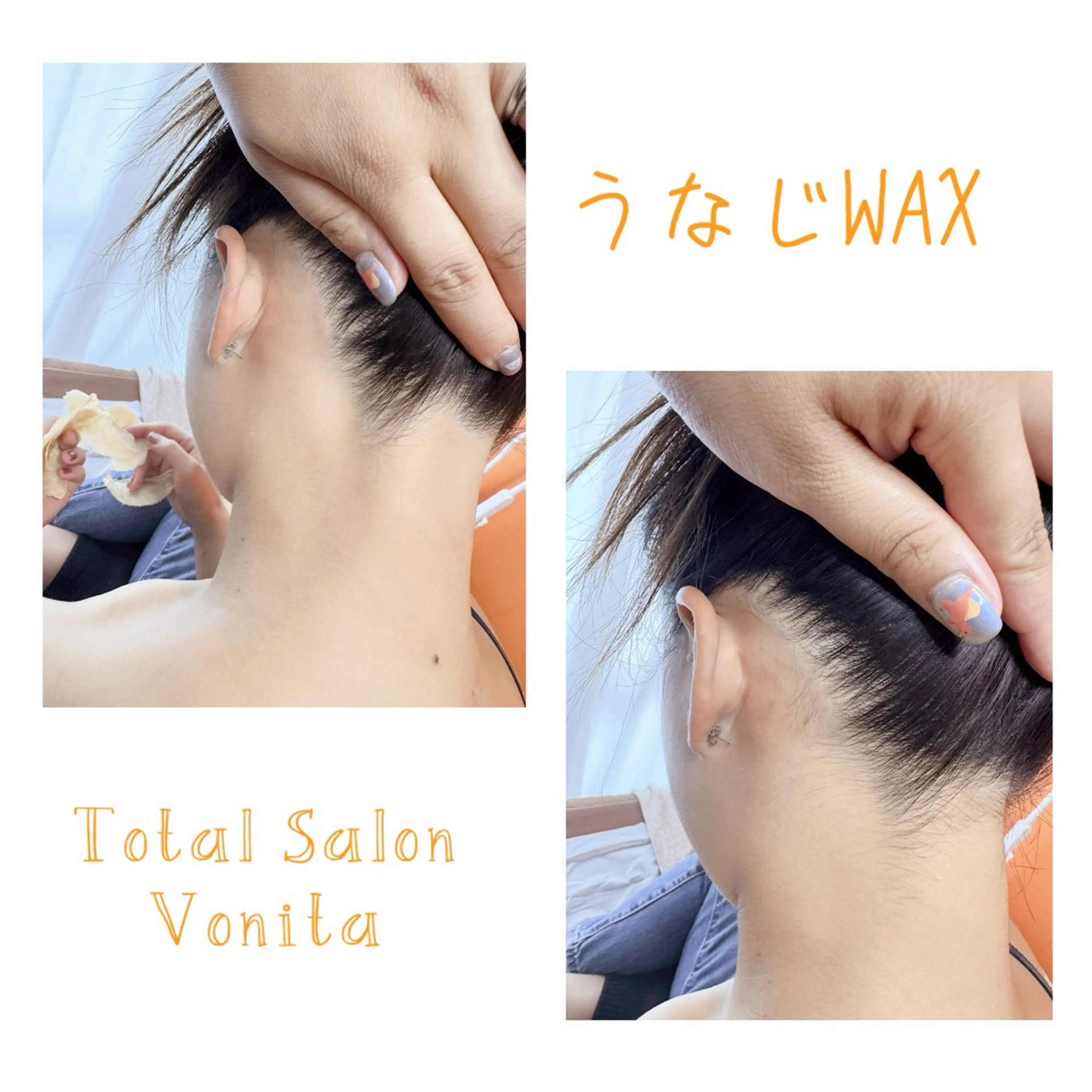 うなじダブル脱毛👱🏻‍♀️ブラジリアンワックス＋最新光脱毛🧡の写真