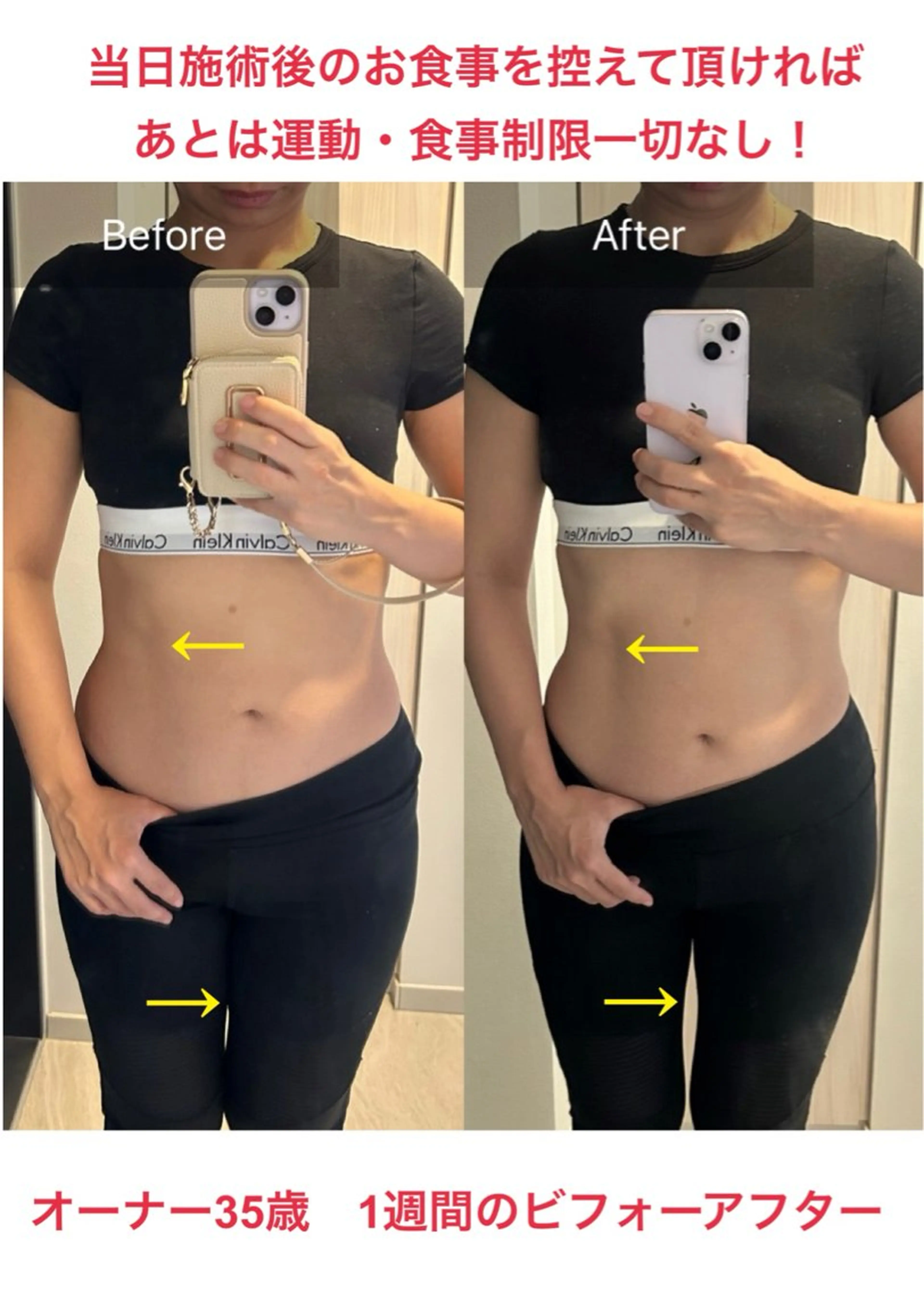 1回で変化が見える最強痩身レモン🍋10ccの写真