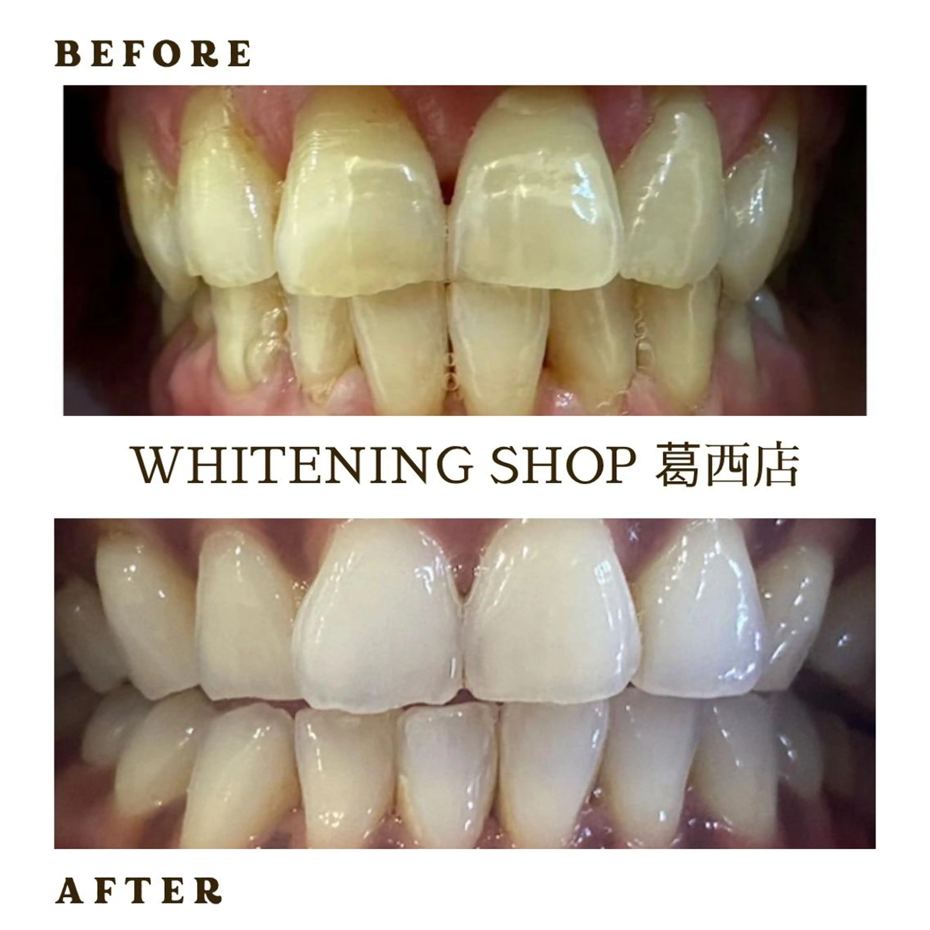 メンズ その他 ホワイトニング ショップ葛西店のその他イメージ