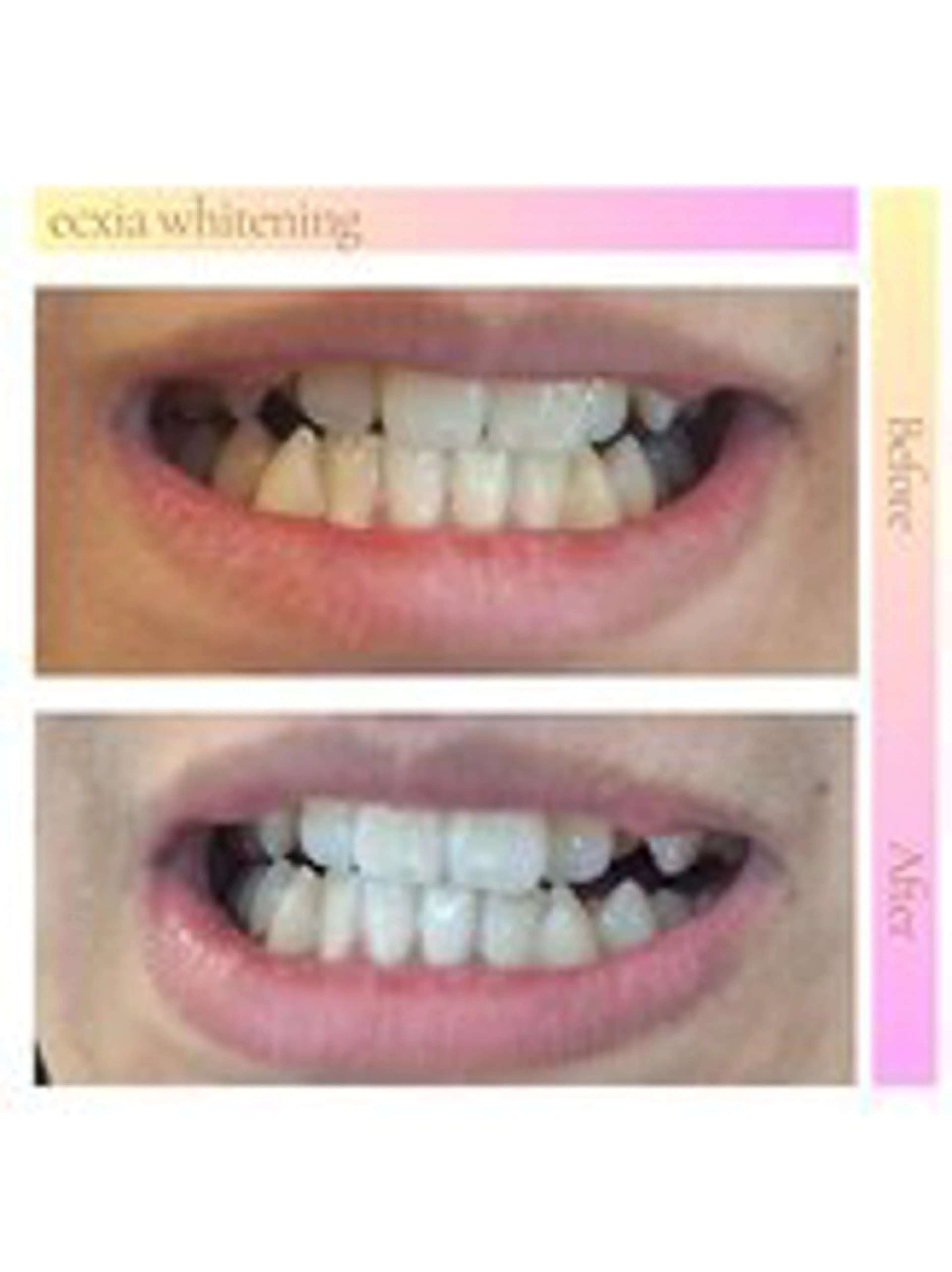 セルフホワイトニング エクシア西宮北口店所属・セルフホワイトニング エクシア西宮北口店のその他イメージ