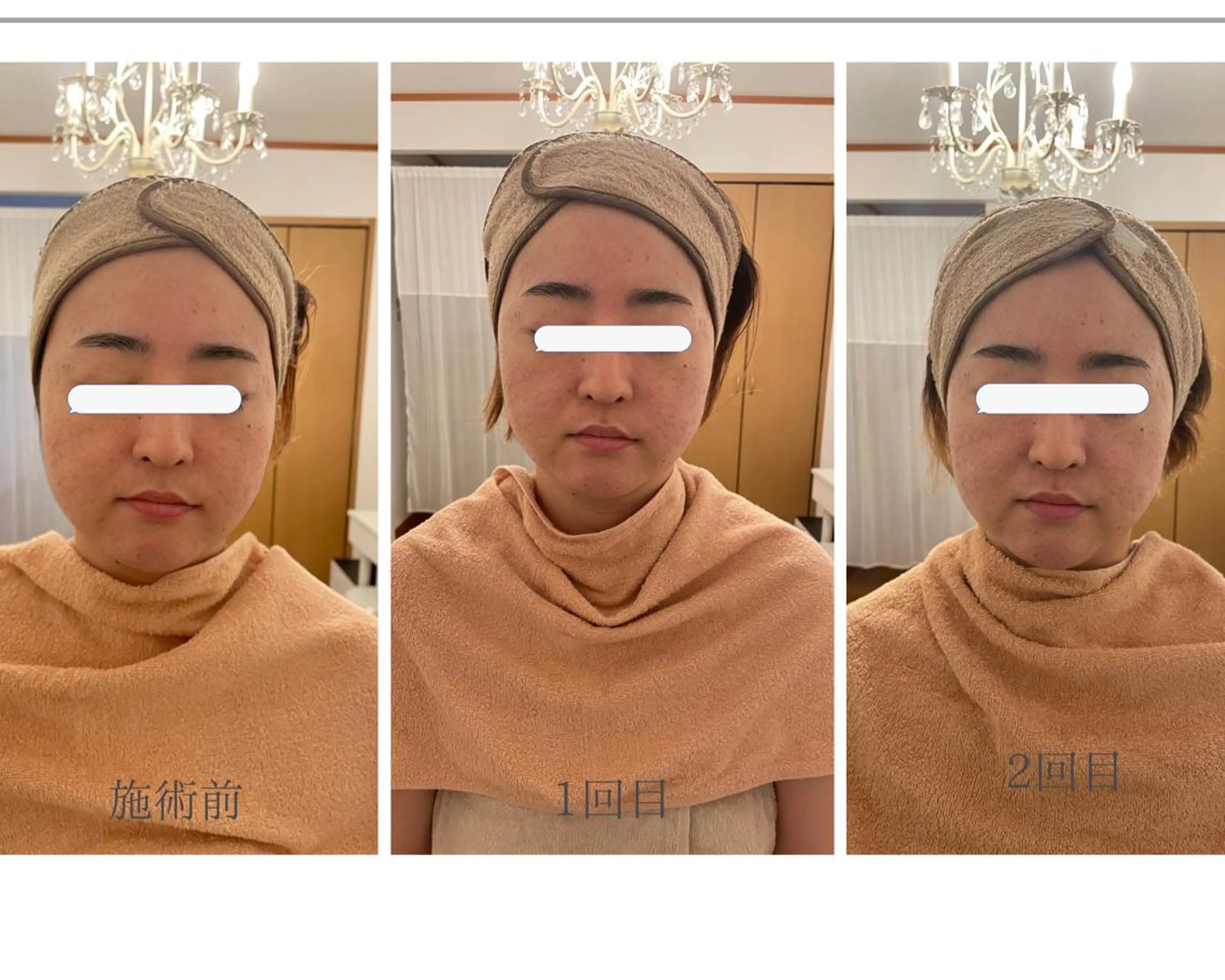 MA CHÉRIE所属・体質別痩身&小顔 MA CHÉRIEのエステ・リラクイメージ