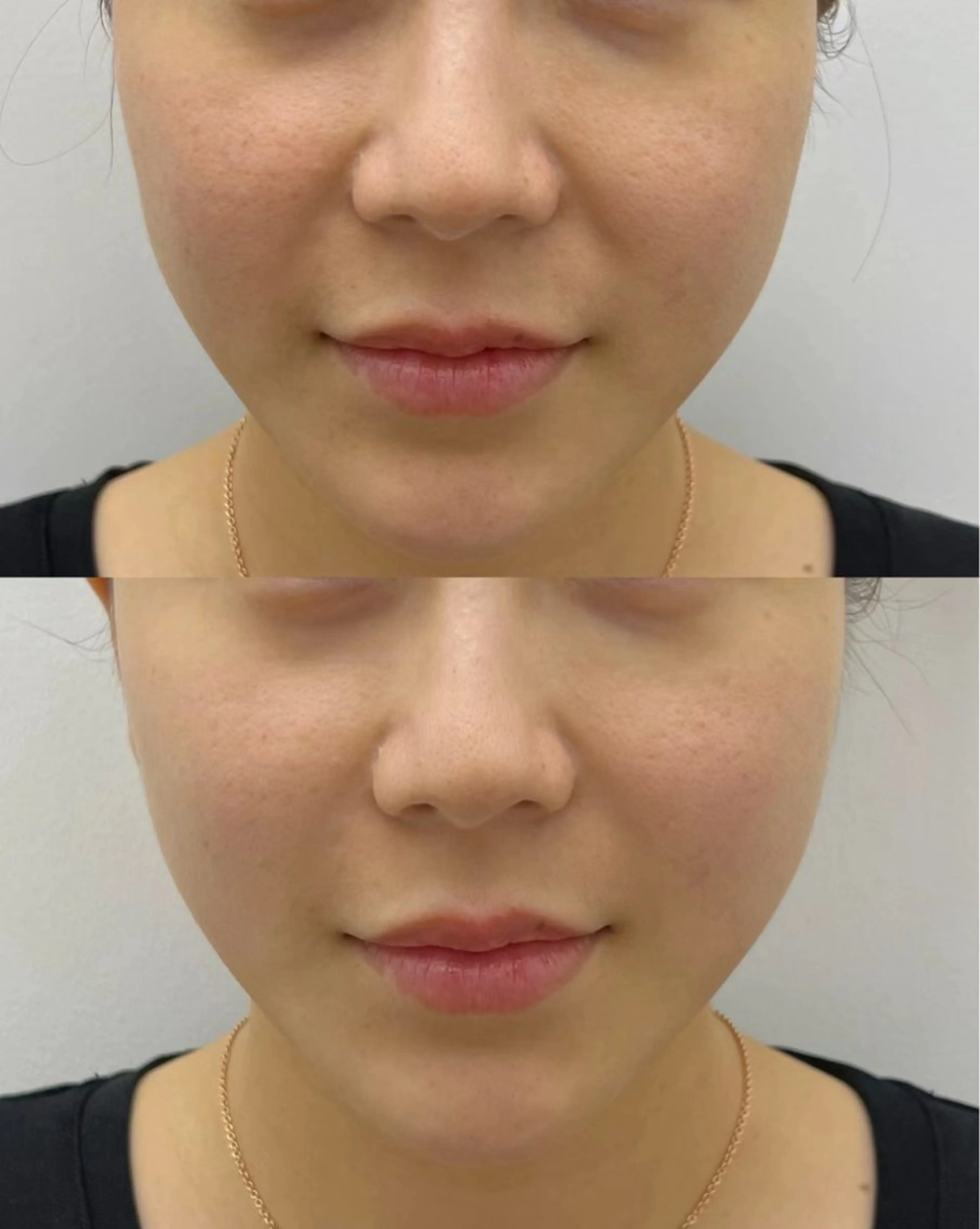 エステ Stars beautyのエステ・リラクイメージ