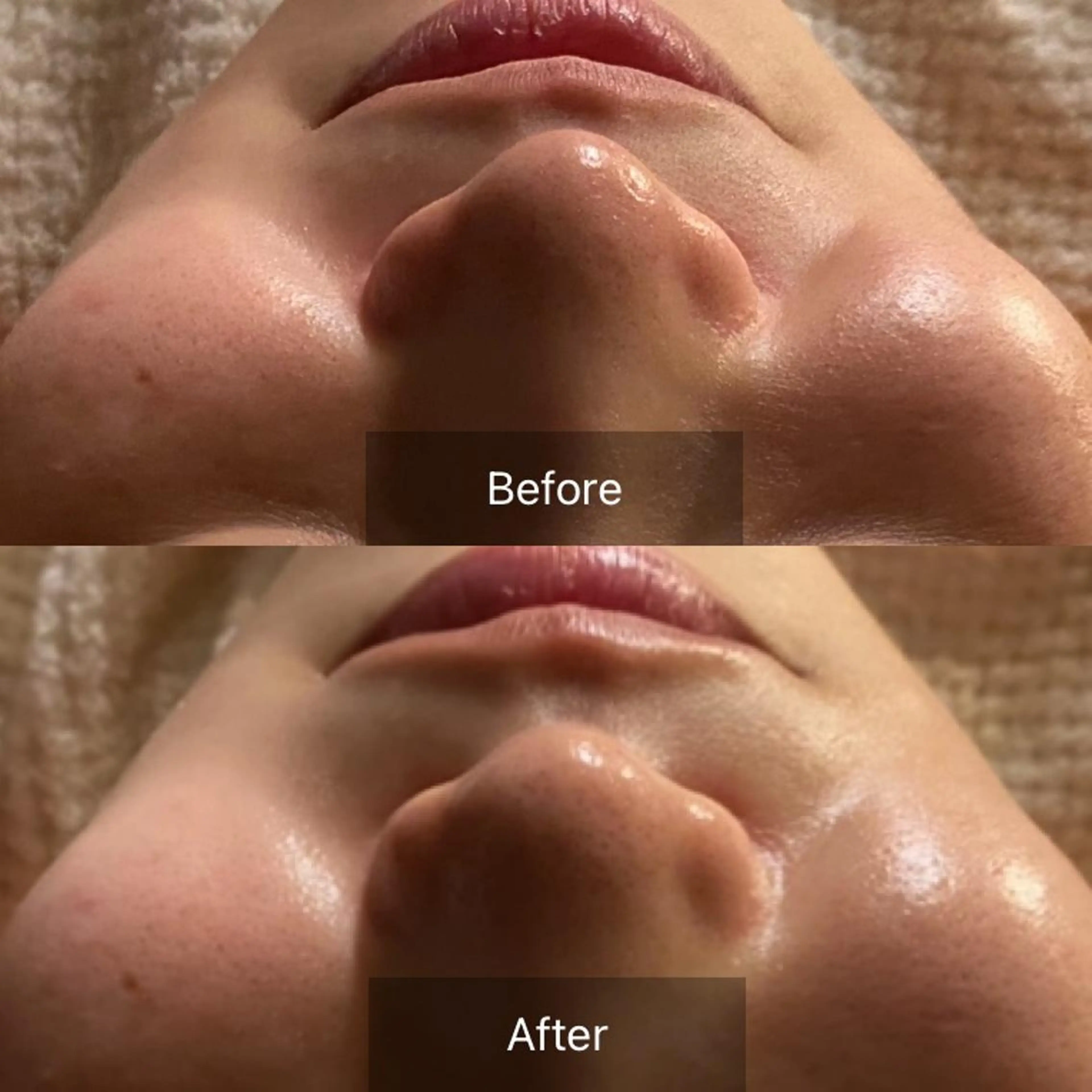 Mandarin Orange所属・毛穴から始める肌メン テマンダリンオレンジのエステ・リラクイメージ