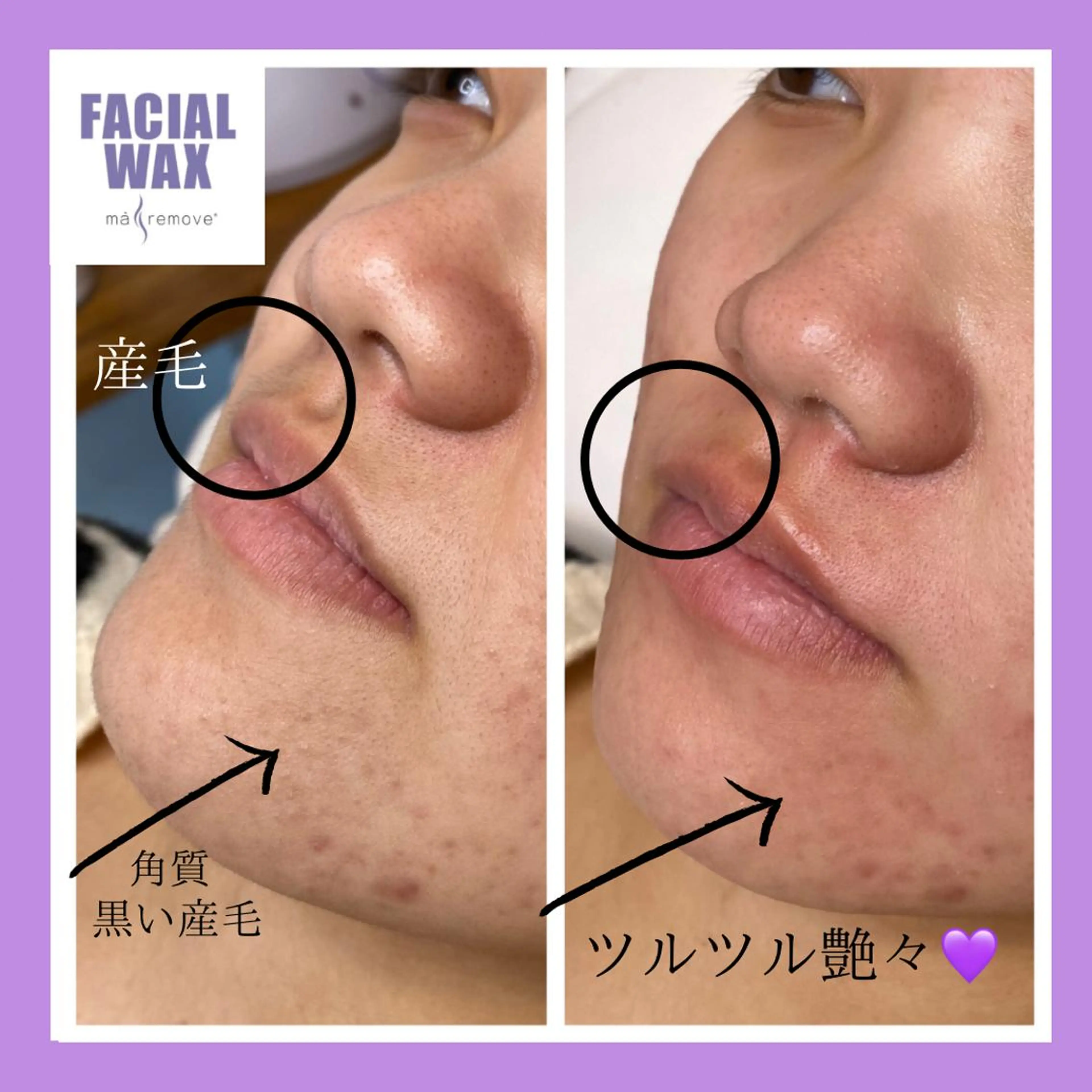 マリムーブ💜フェイシャルワックス🍯🧹の写真