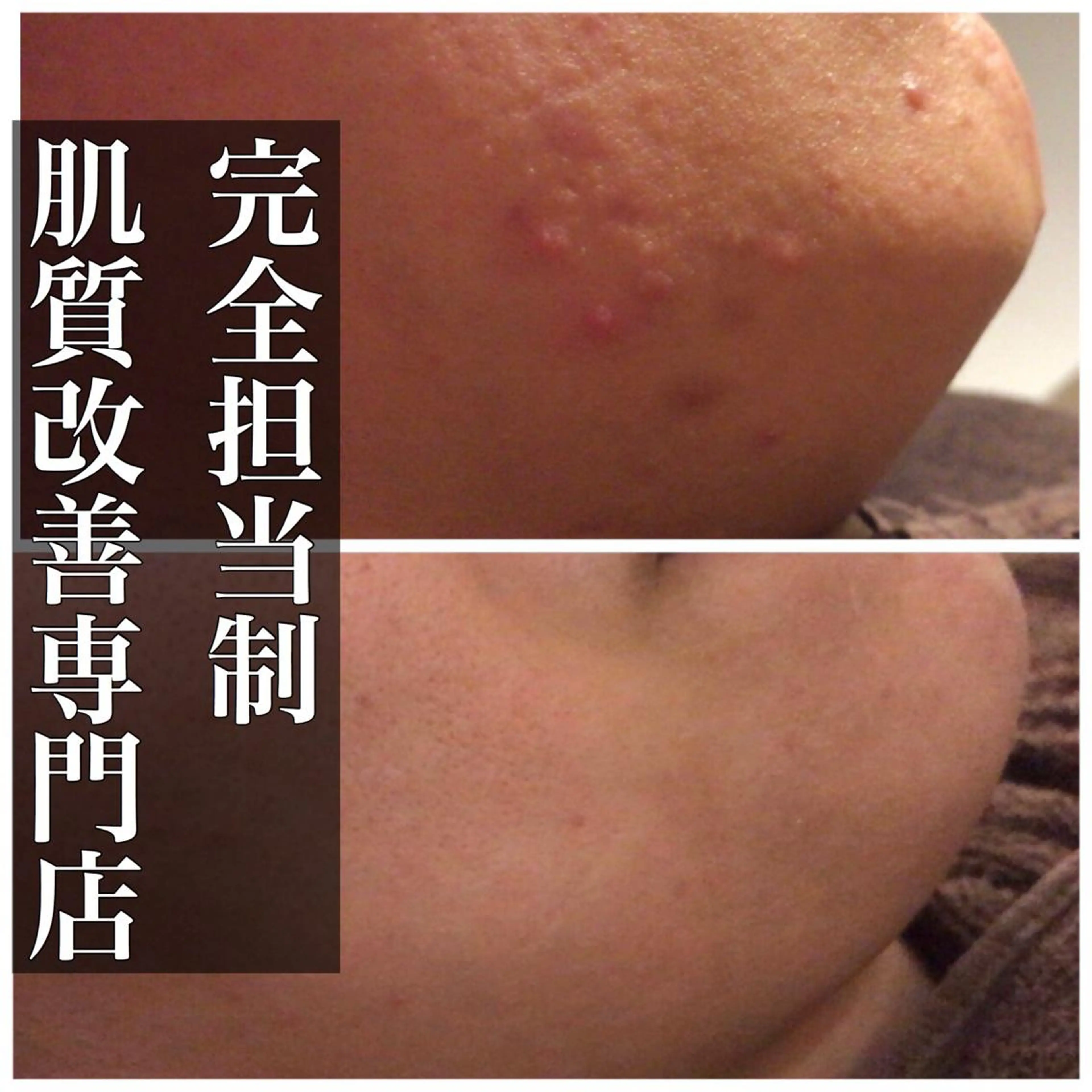 ミディアム カラー パーマ ヘアアレンジ メンズ キッズ ネイル マツエク・マツパ エステ リラク ニキビ・肌質改善専門 ♡人生が変わるサロンのエステ・リラクイメージ