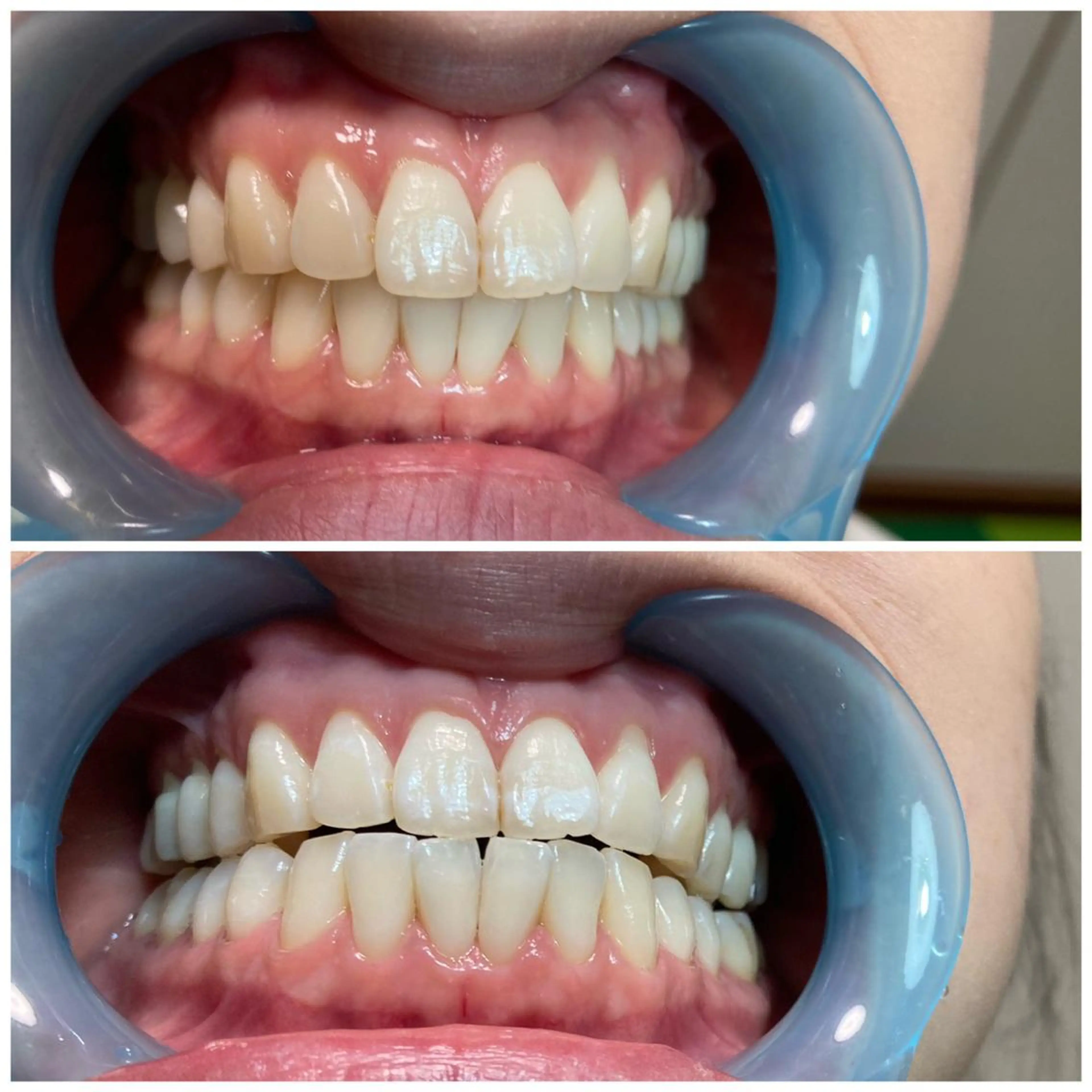 プライベートサロン Lｏｋａｈｉ飯生透のエステ・リラクイメージ