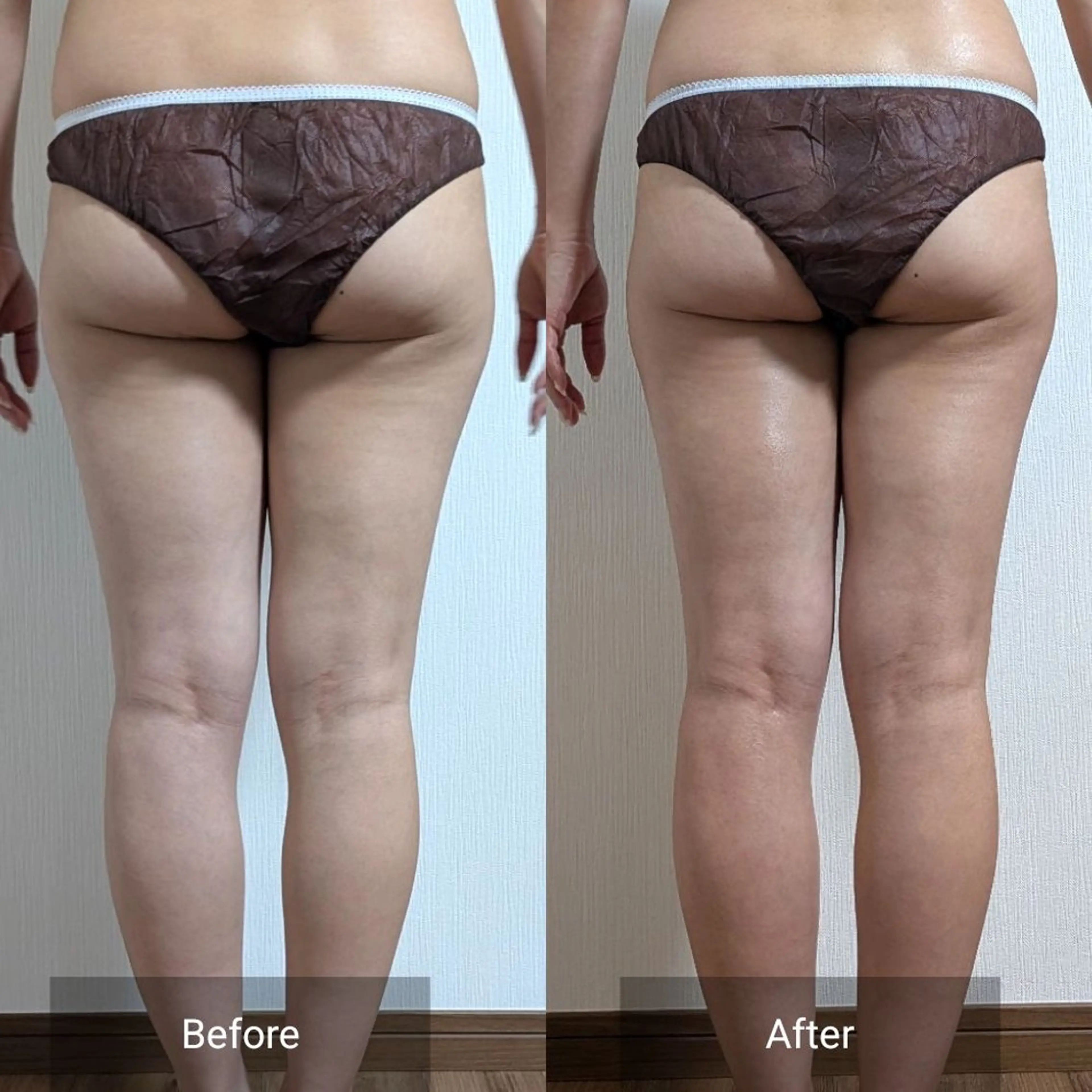 エステ nail RiRi アトレナチュラのエステ・リラクイメージ