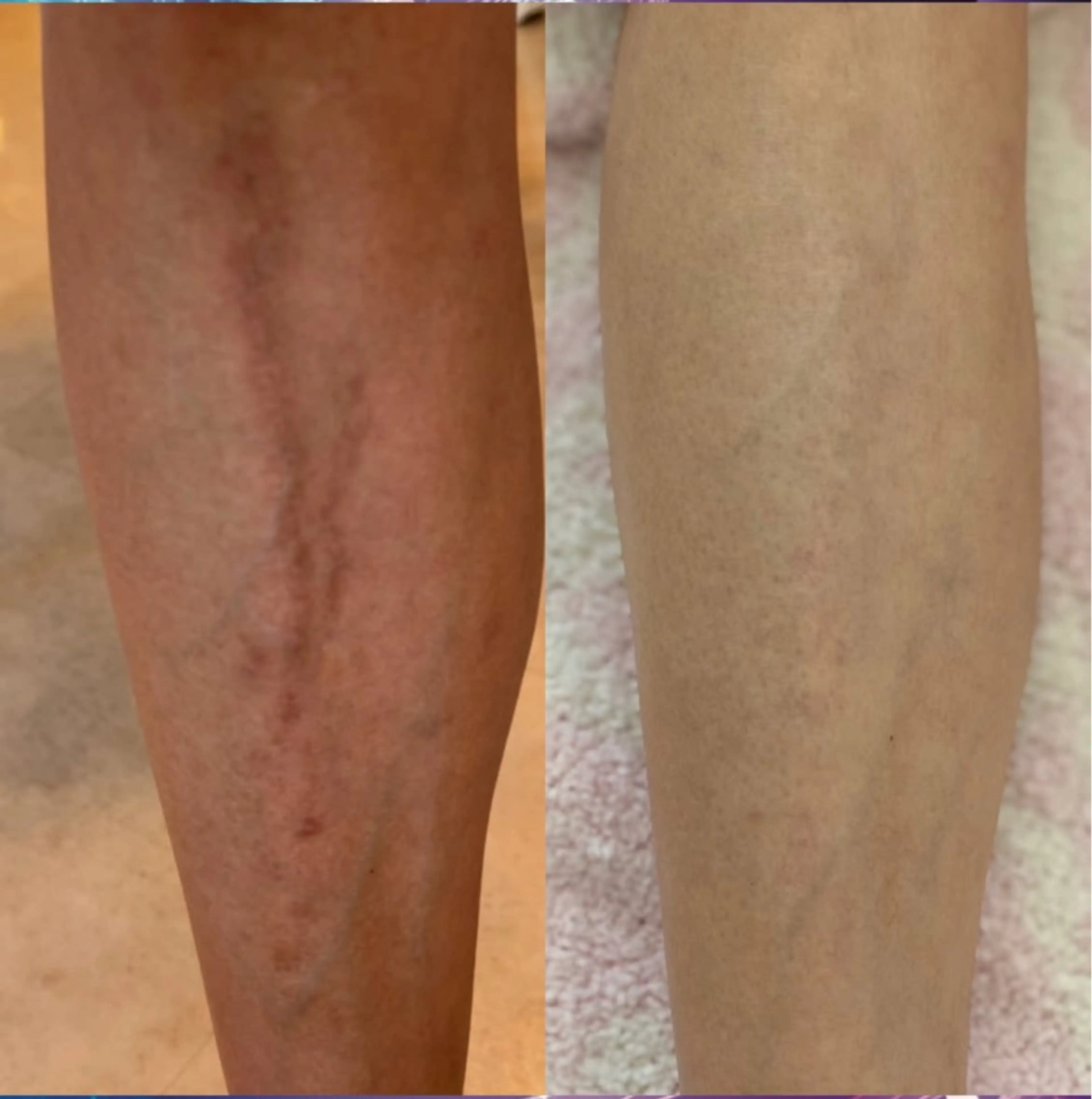 Blooming所属・LOUISE. ／肌質・頭皮のエステ・リラクイメージ