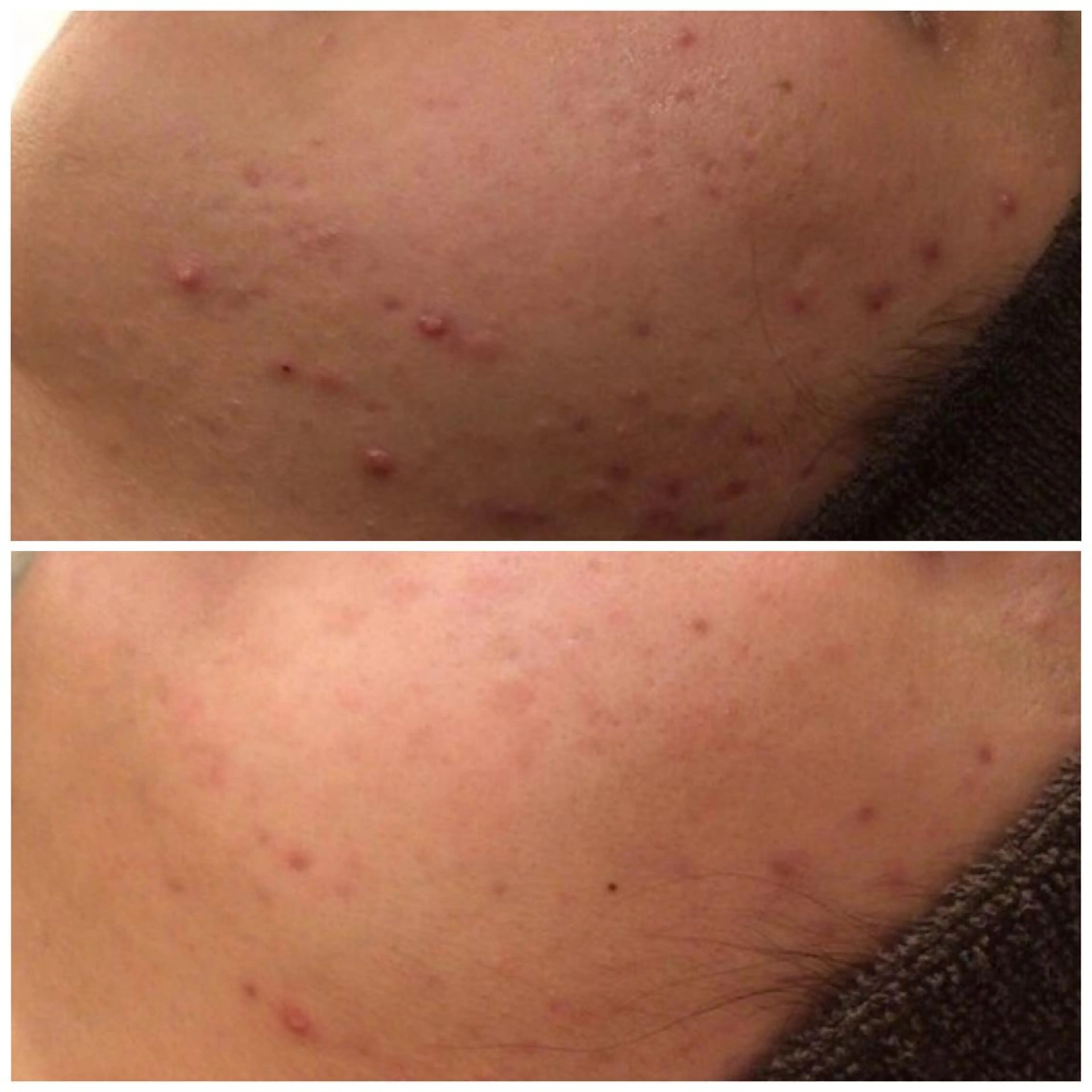 触れたくなる モテ肌へ...❤︎のエステ・リラクイメージ