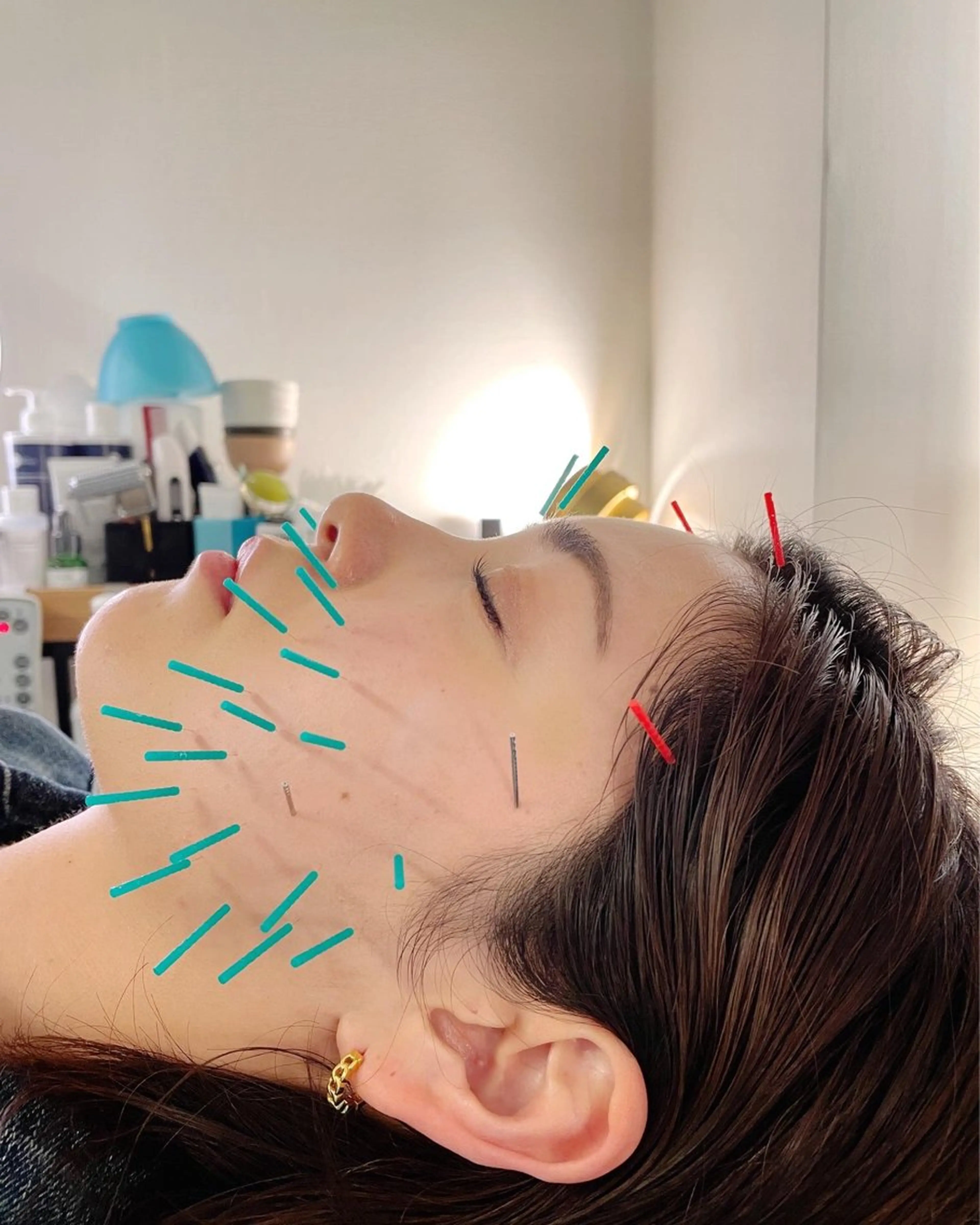 エステ リラク 小顔美容鍼専門サロン 渋谷YZのエステ・リラクイメージ