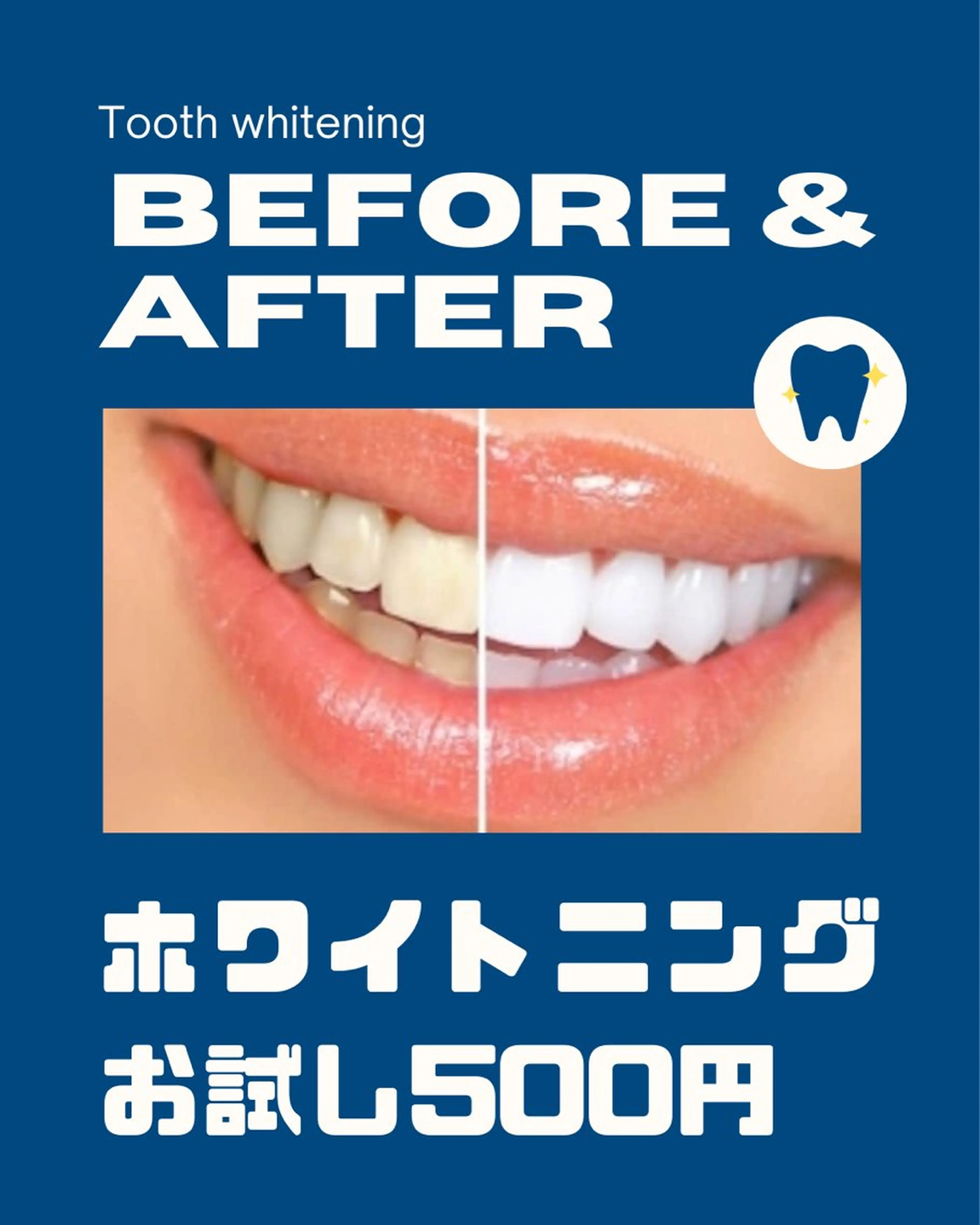 ホワイトニングお試しの写真