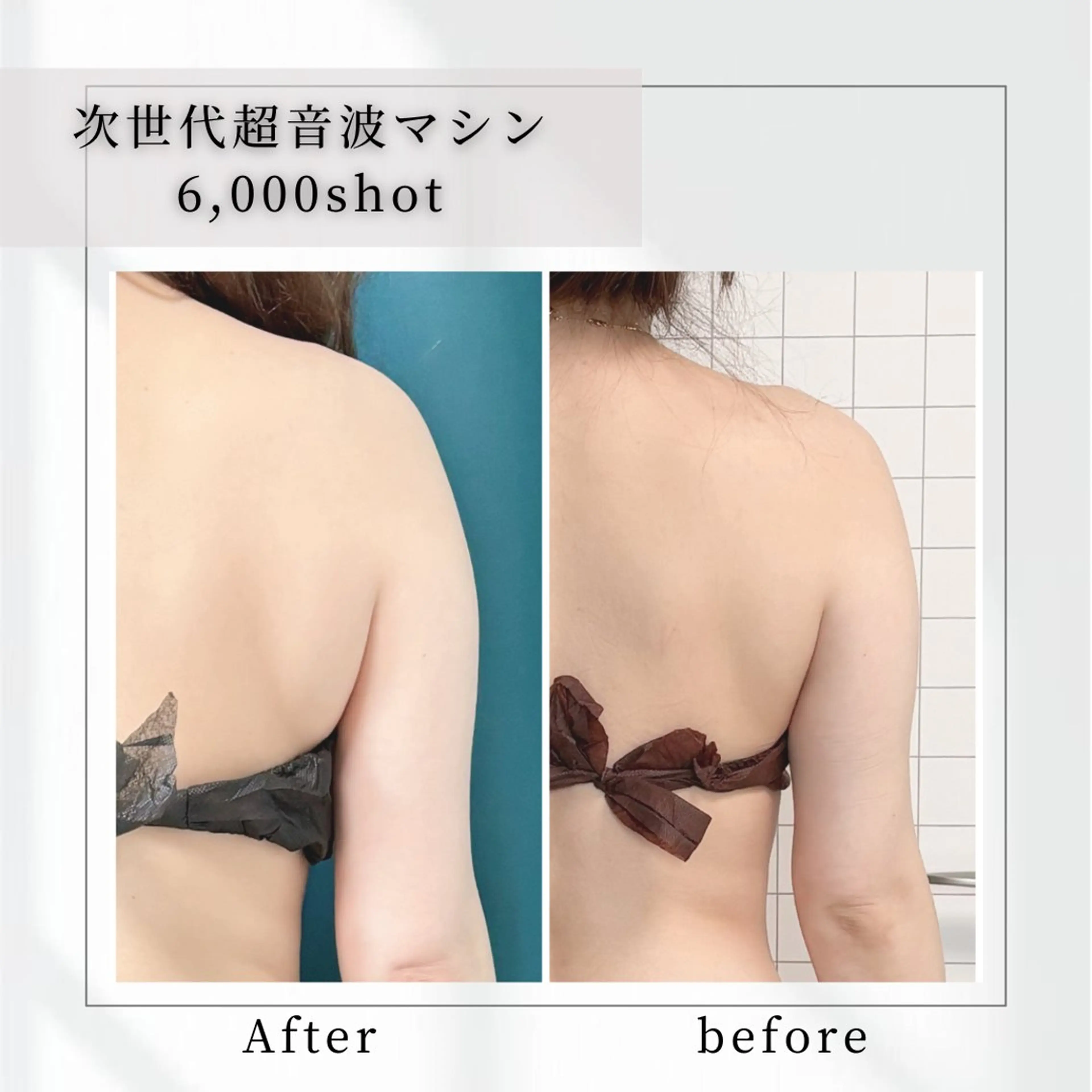 小顔矯正専門店 【RED】池田のエステ・リラクイメージ