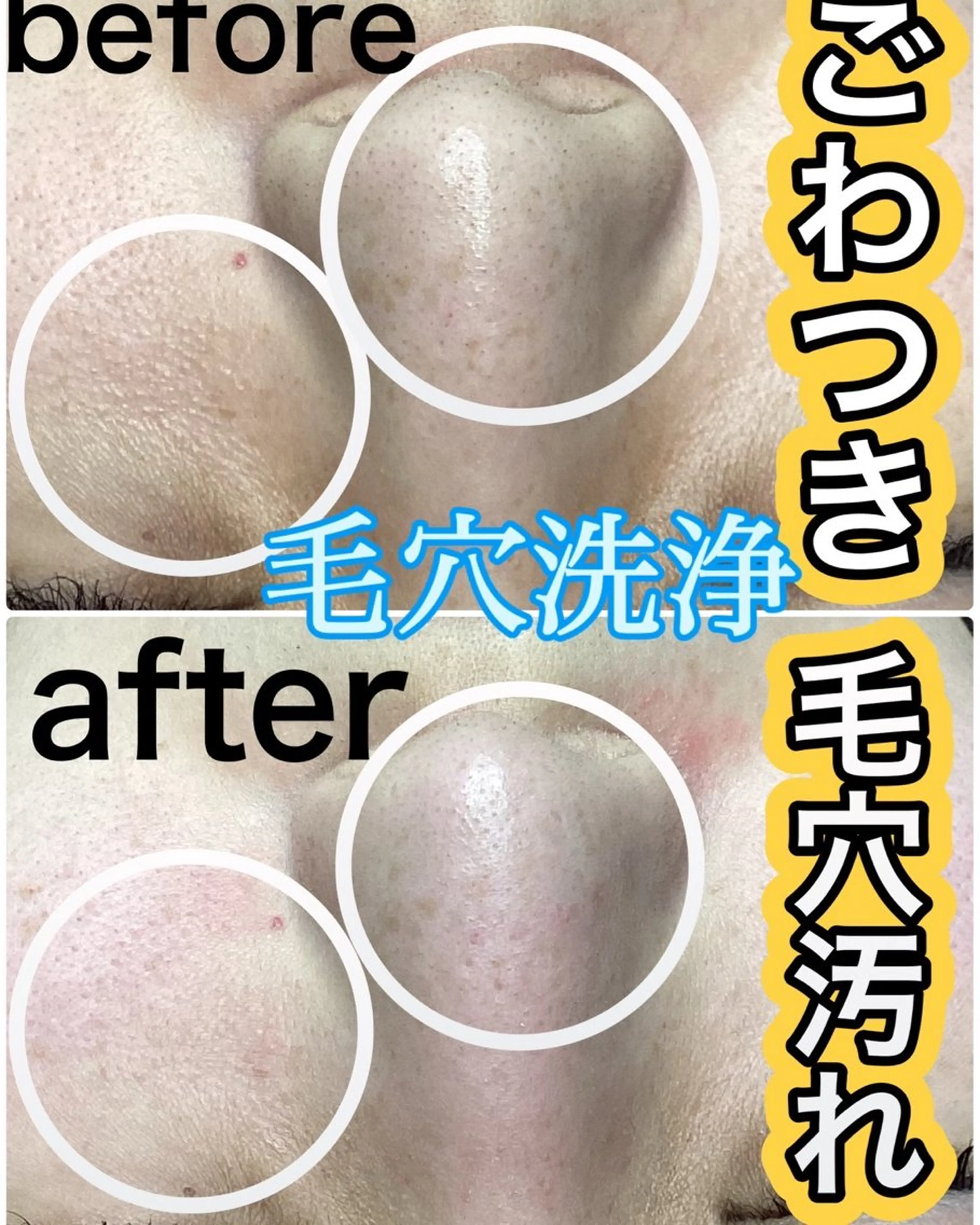 その他 ◯△□所属・最新美肌脱毛 韓国水光肌🫧のその他イメージ