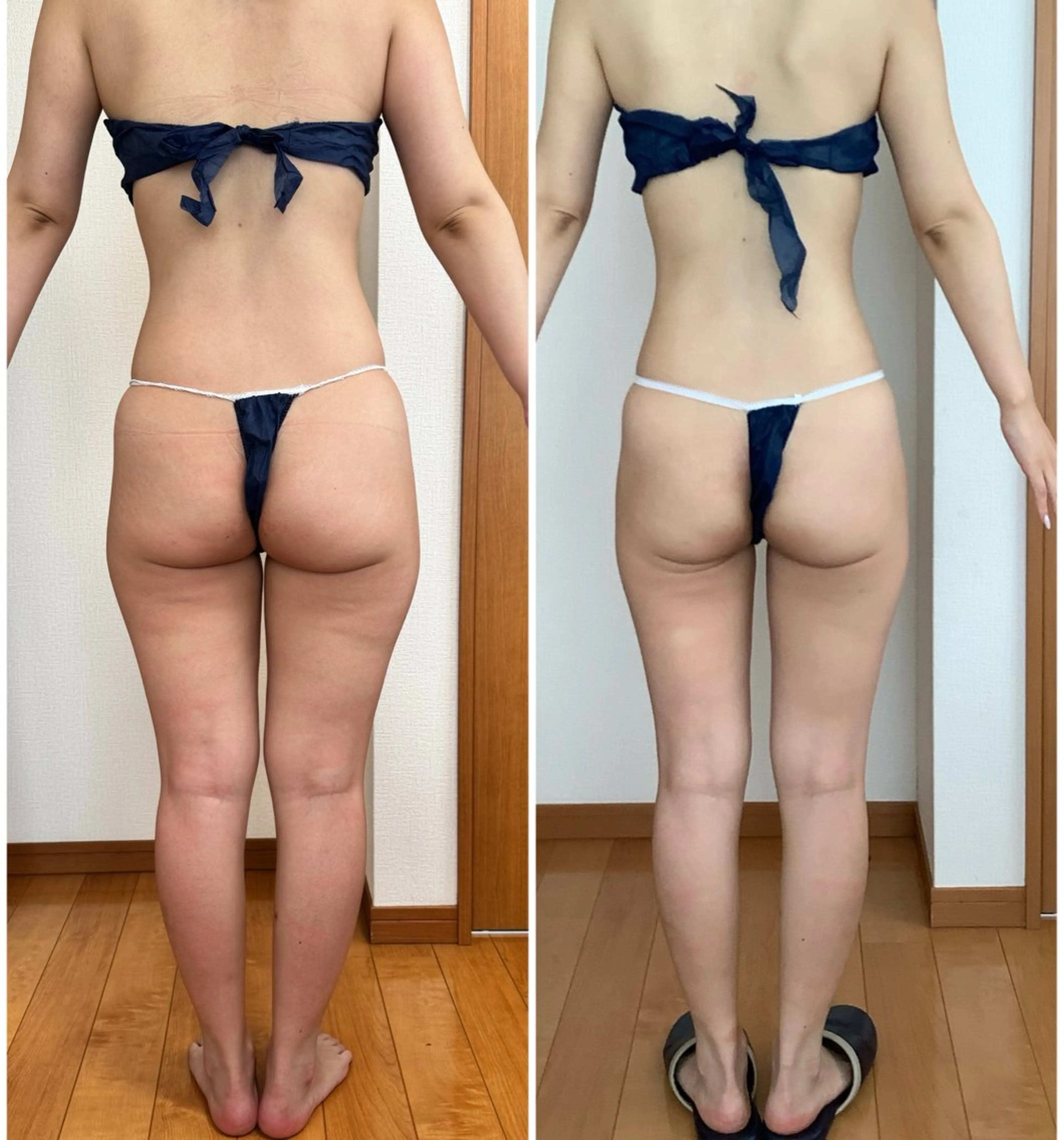 【美脚コース】見せたくなる脚、手に入れませんか？当店人気No. 1！夏に向けて美脚へ⭐︎の写真