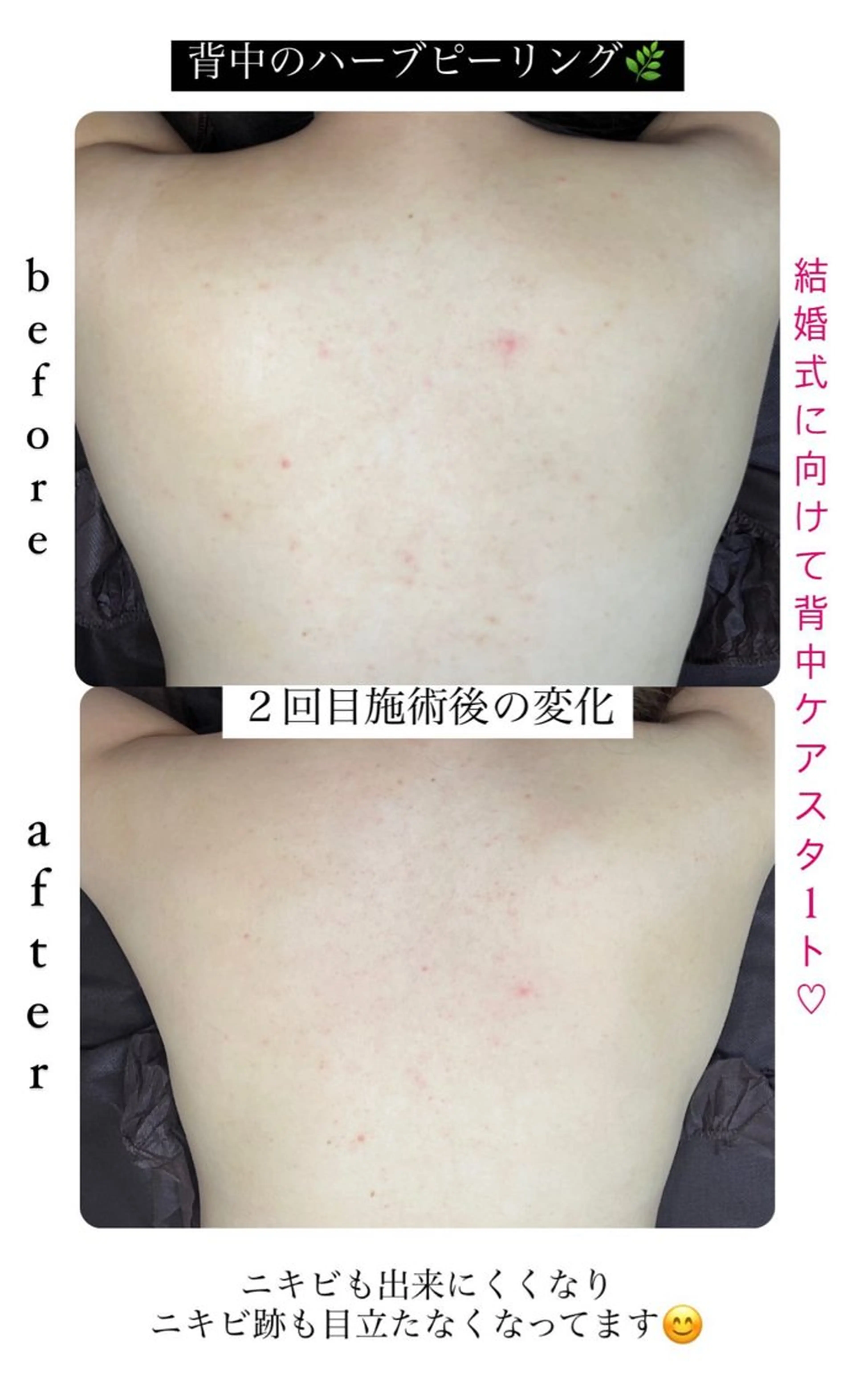 エステ ベラージュ【美背中・ 美尻・フェイシャル】のエステ・リラクイメージ