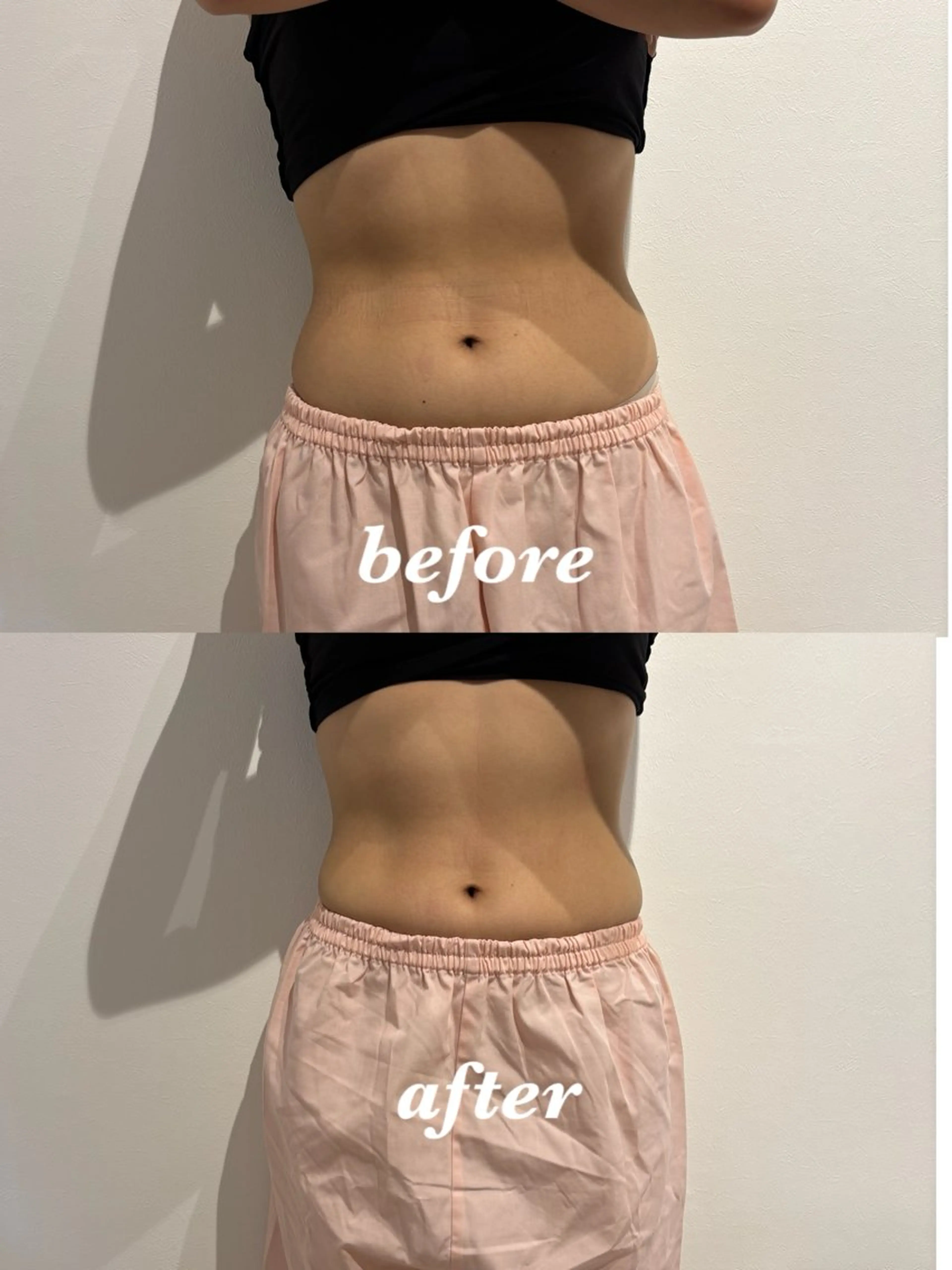 メンズ その他 腸活サポート みなみののエステ・リラクイメージ