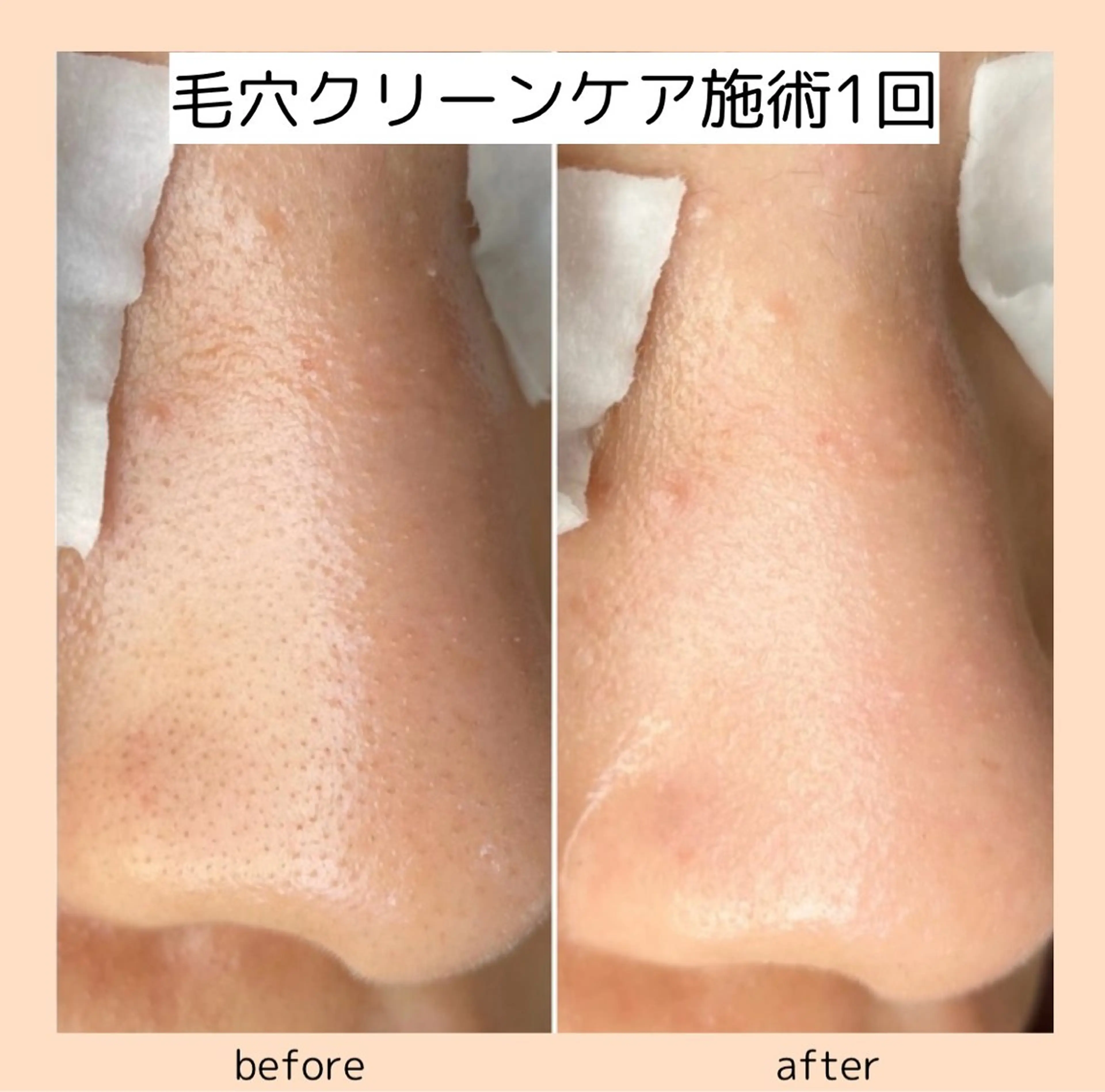 【three】毛穴/ 肌改善/小顔/耳ツボのエステ・リラクイメージ