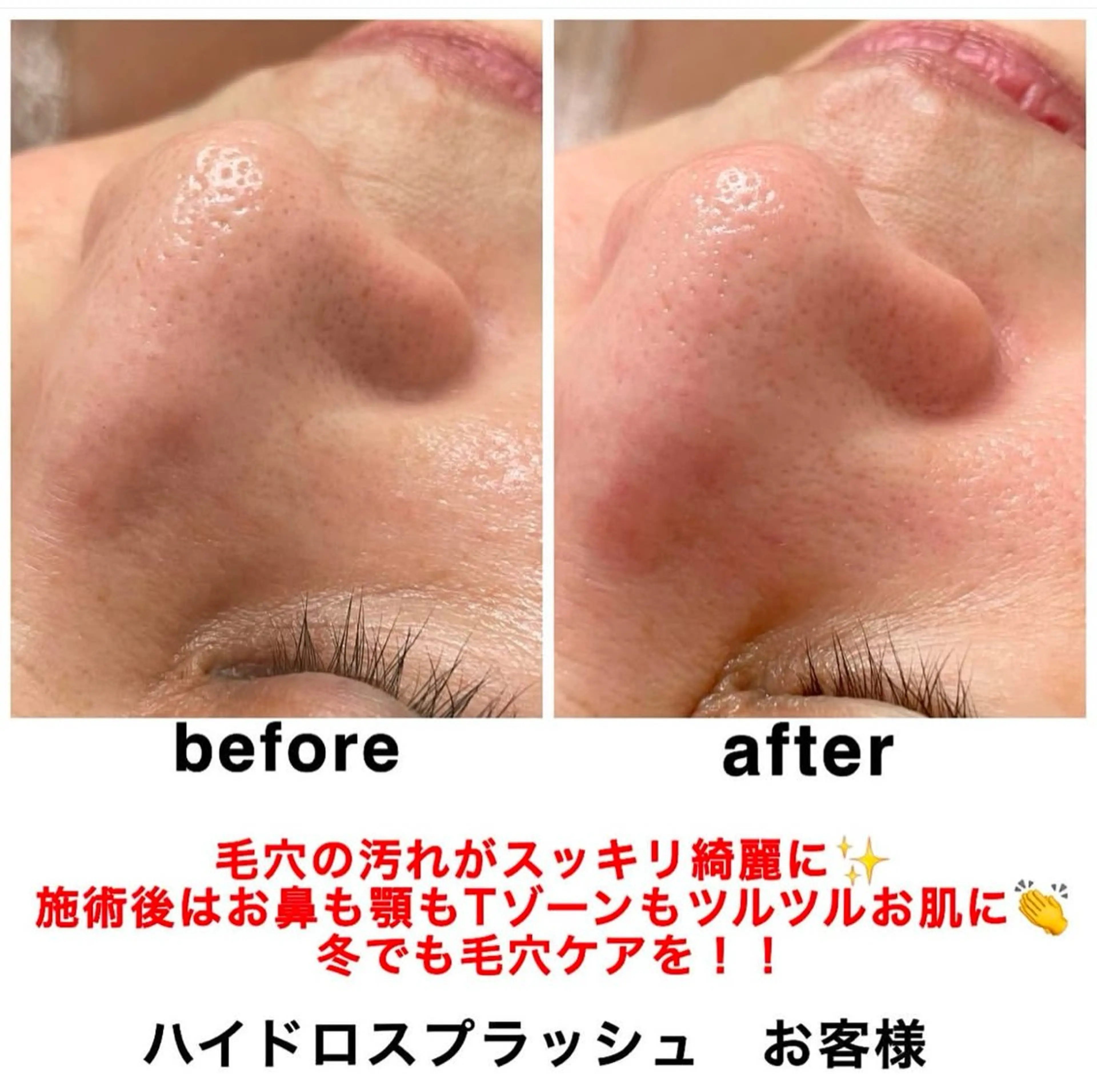 エステ リラク ネイル・エステサロンUILANI所属・ネイル・エステサロン UILANIのネイルデザイン