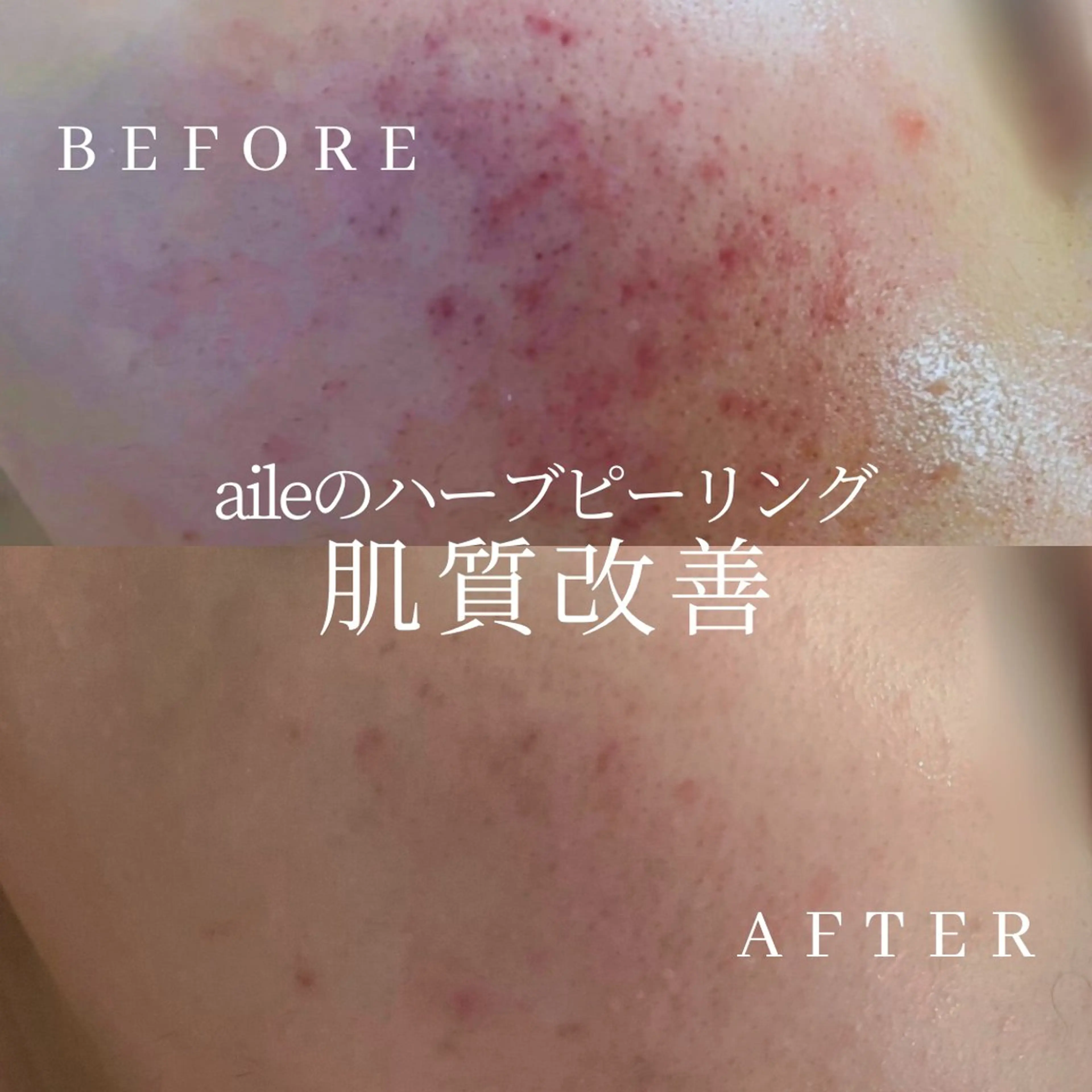 エステ サロンド エルのエステ・リラクイメージ