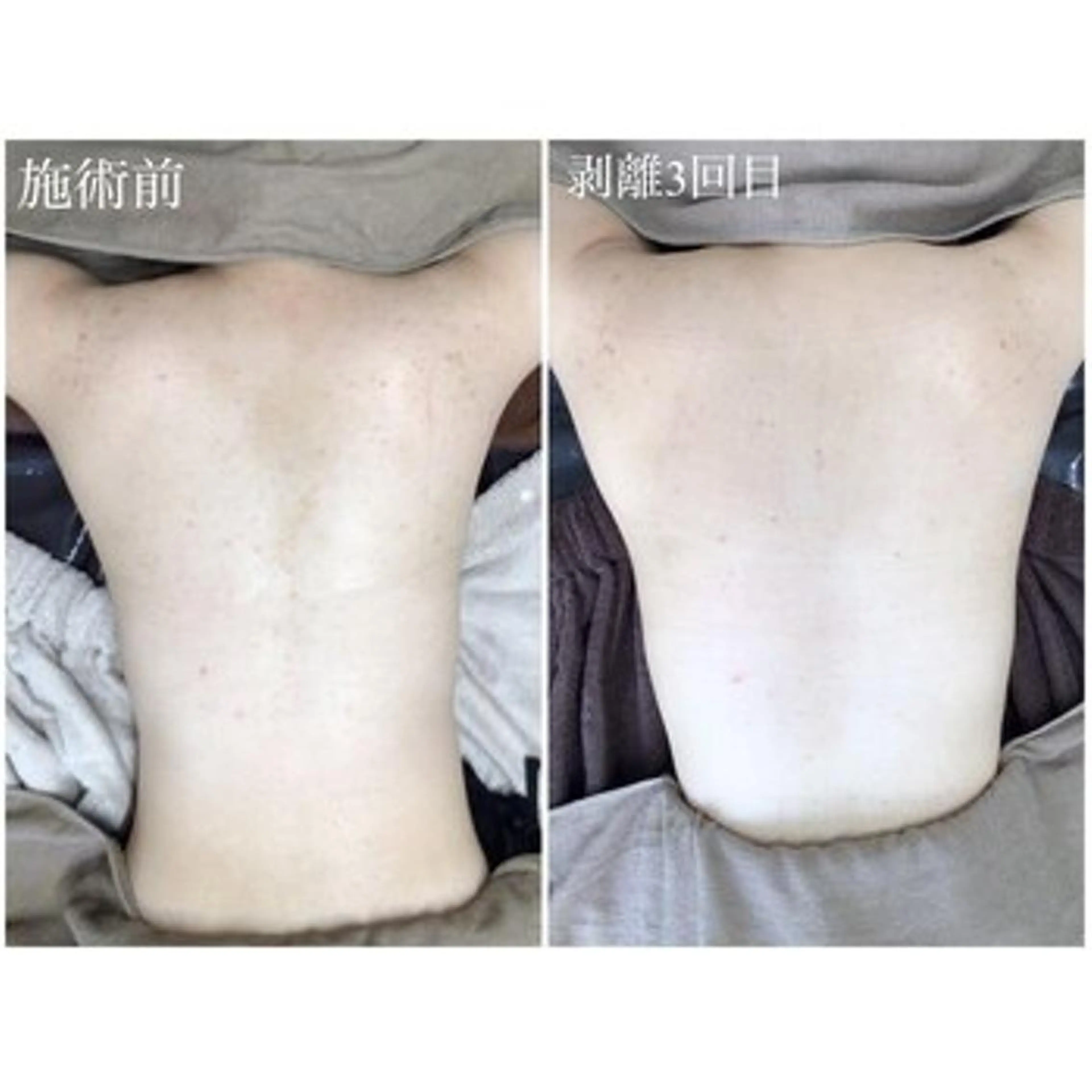 エステ 毛穴/毛穴洗浄専門 エミルカ船橋のエステ・リラクイメージ