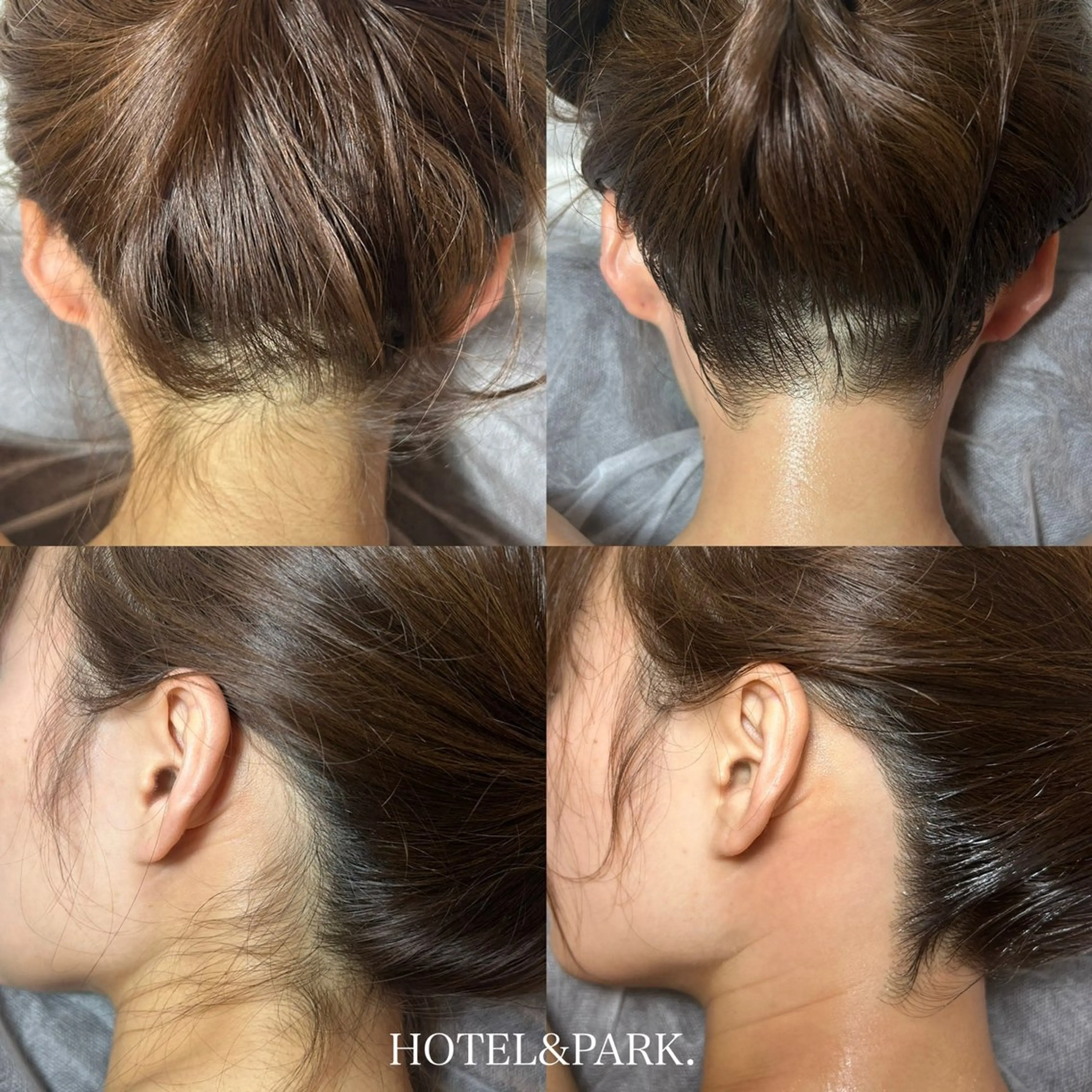 HOTEL&PARK .Moeワックス脱毛のエステ・リラクイメージ