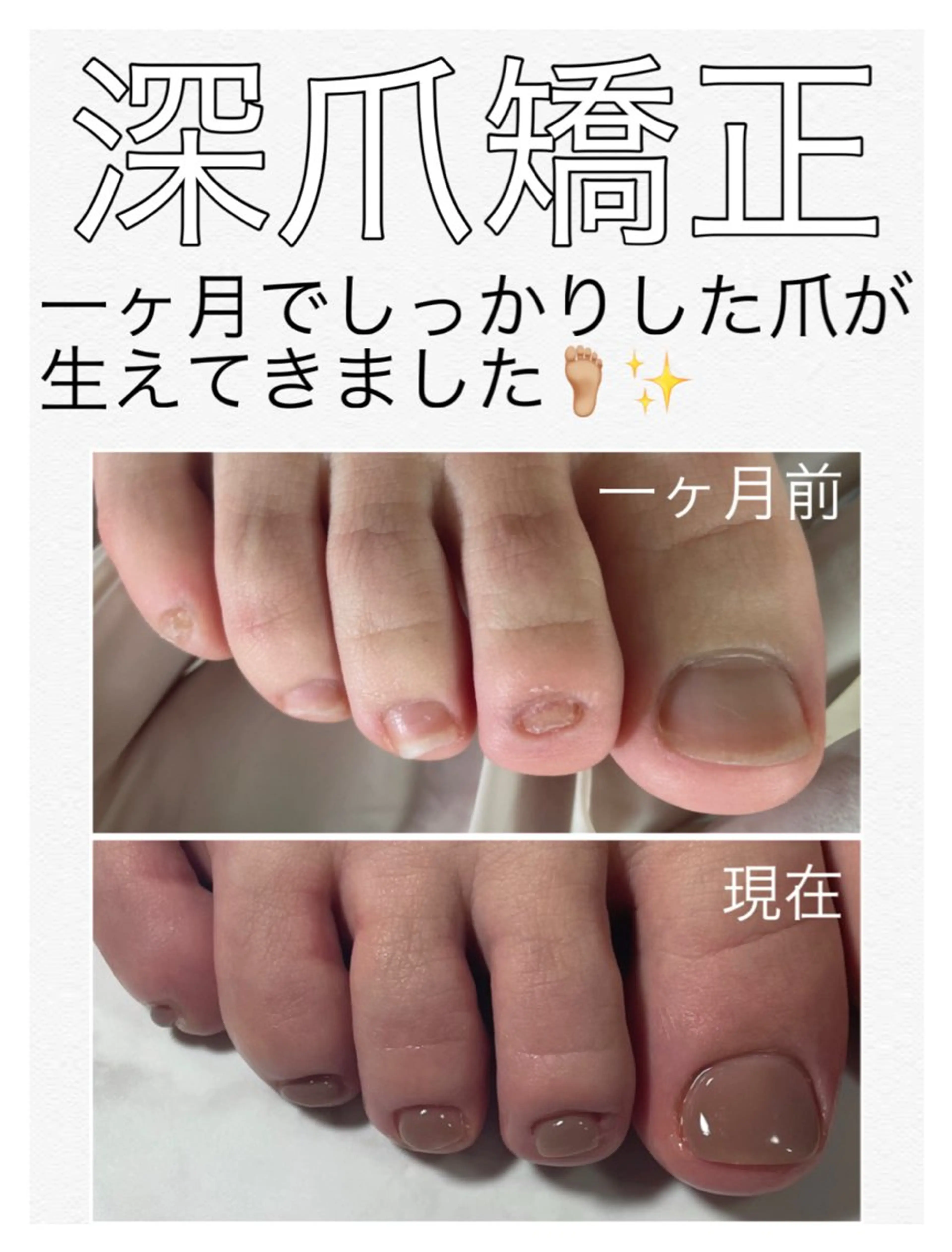 ネイル 長さ出し フットネイル petillant所属・nail salon petillantのネイルデザイン