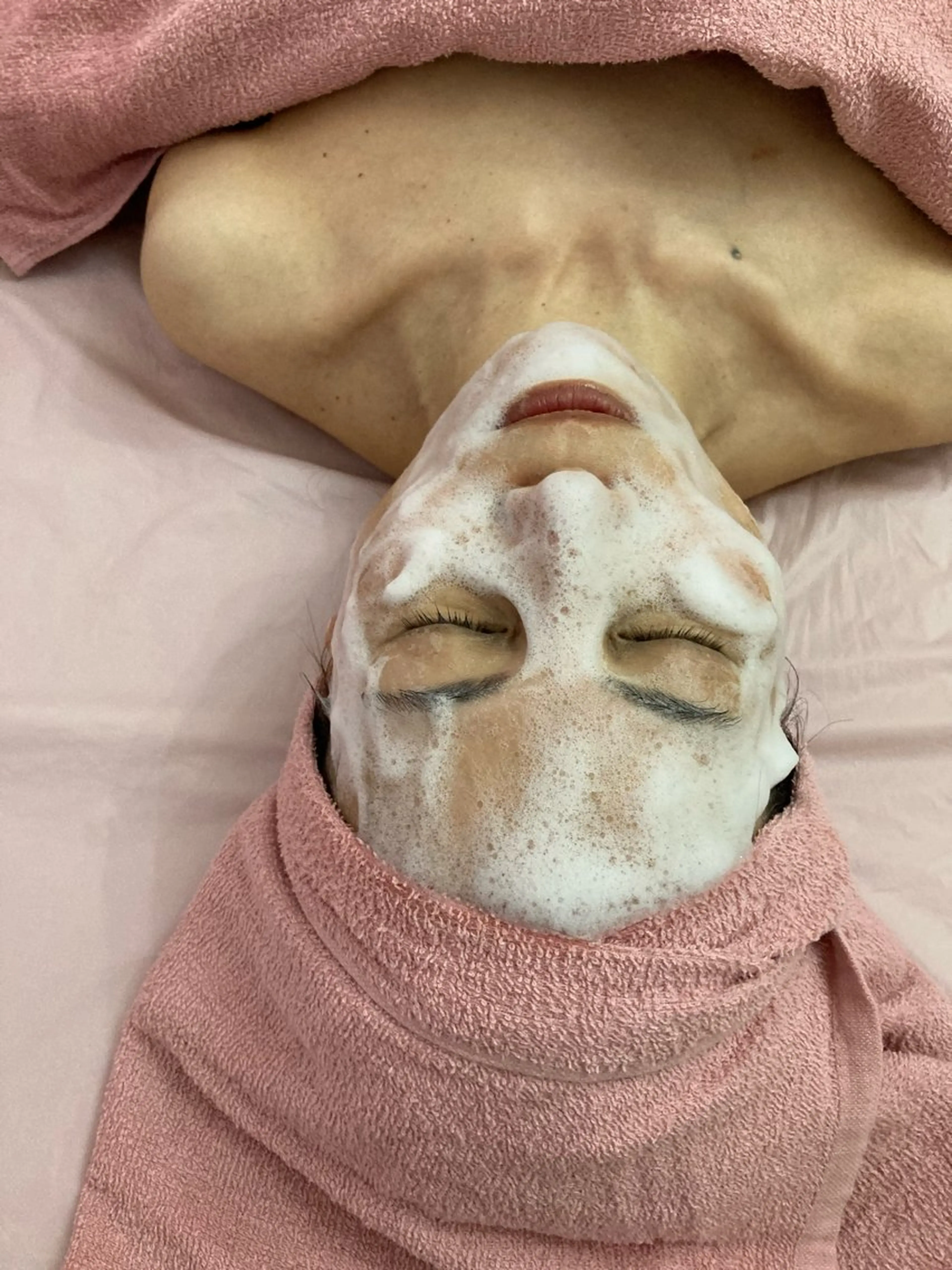 エステ リラク hitohana所属・毛穴/いちご鼻/小顔 /hitohanaのエステ・リラクイメージ