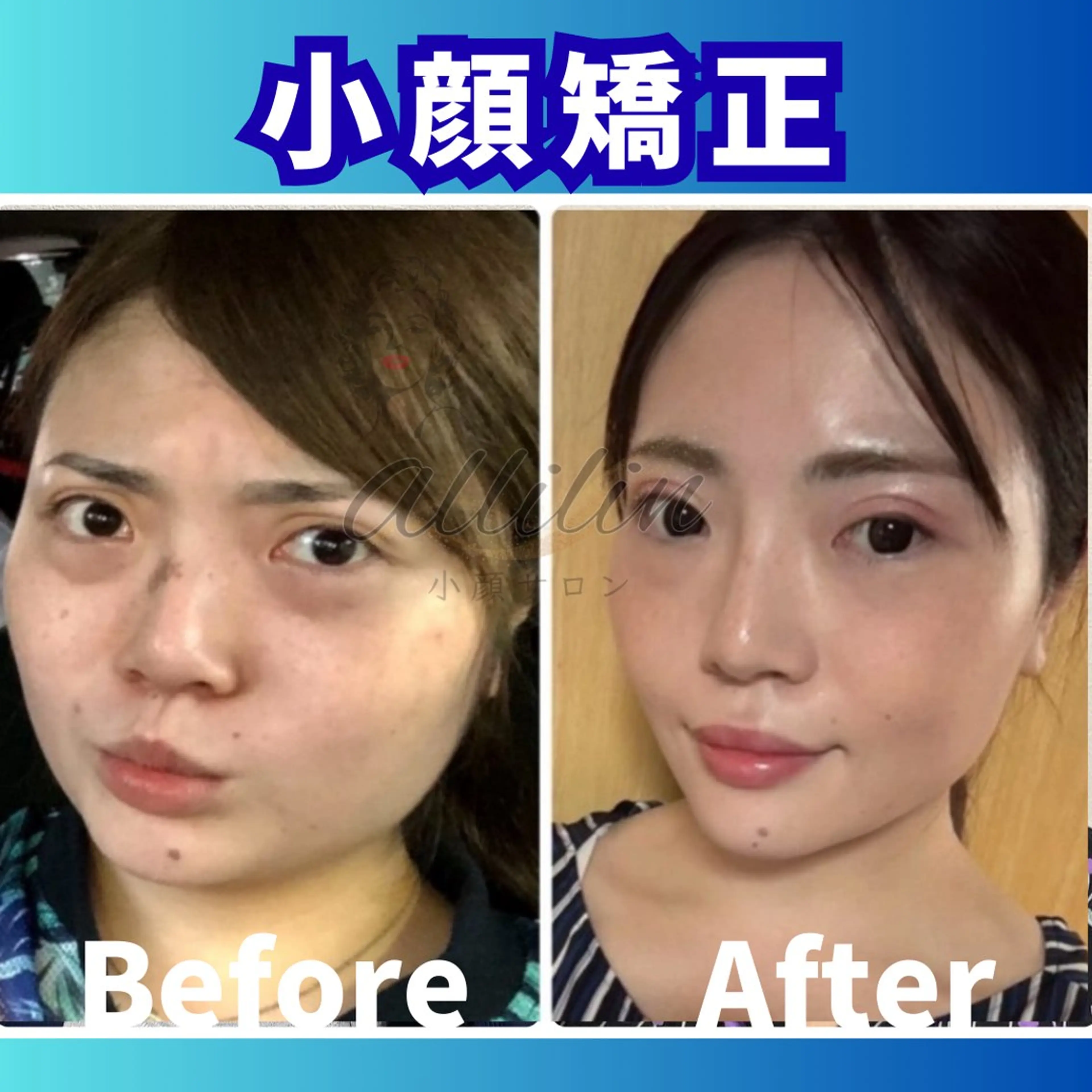 エステ 💎小顔サロン アリリン銀座💎のエステ・リラクイメージ