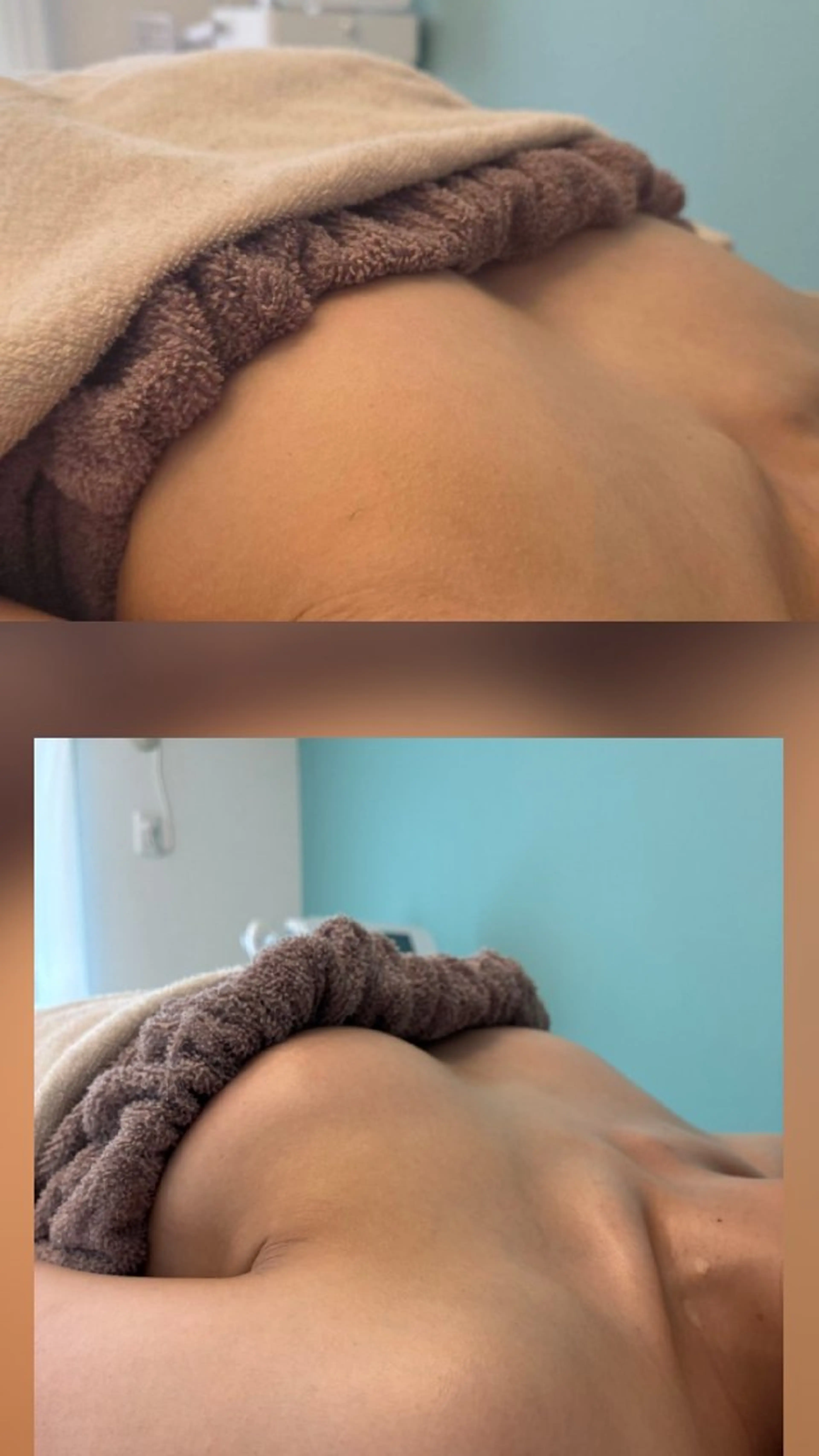 プレオープン割 筋膜リリース全身施術 ふんわりバスト育乳の写真