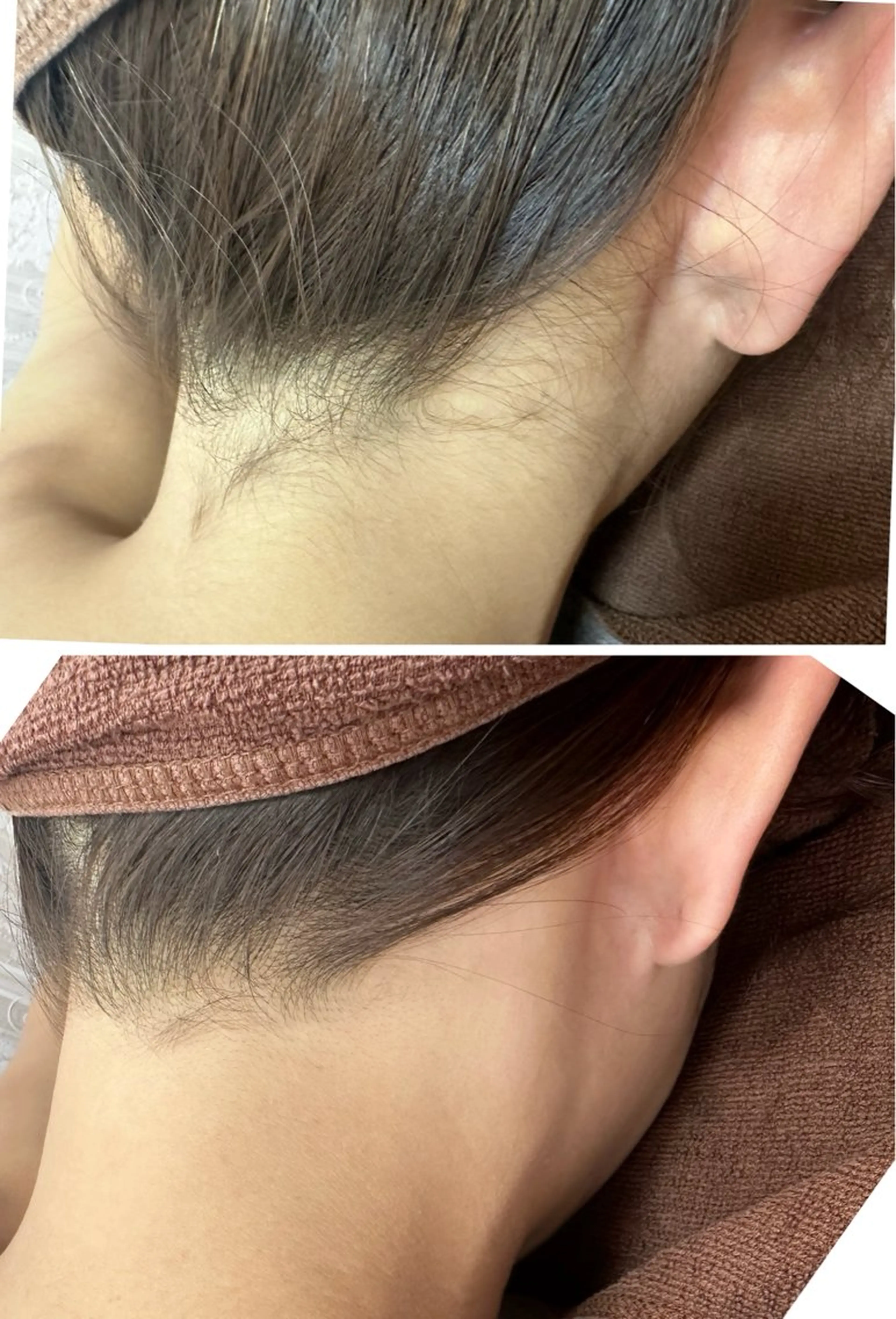 脱毛 ブリリエット 文山のその他イメージ