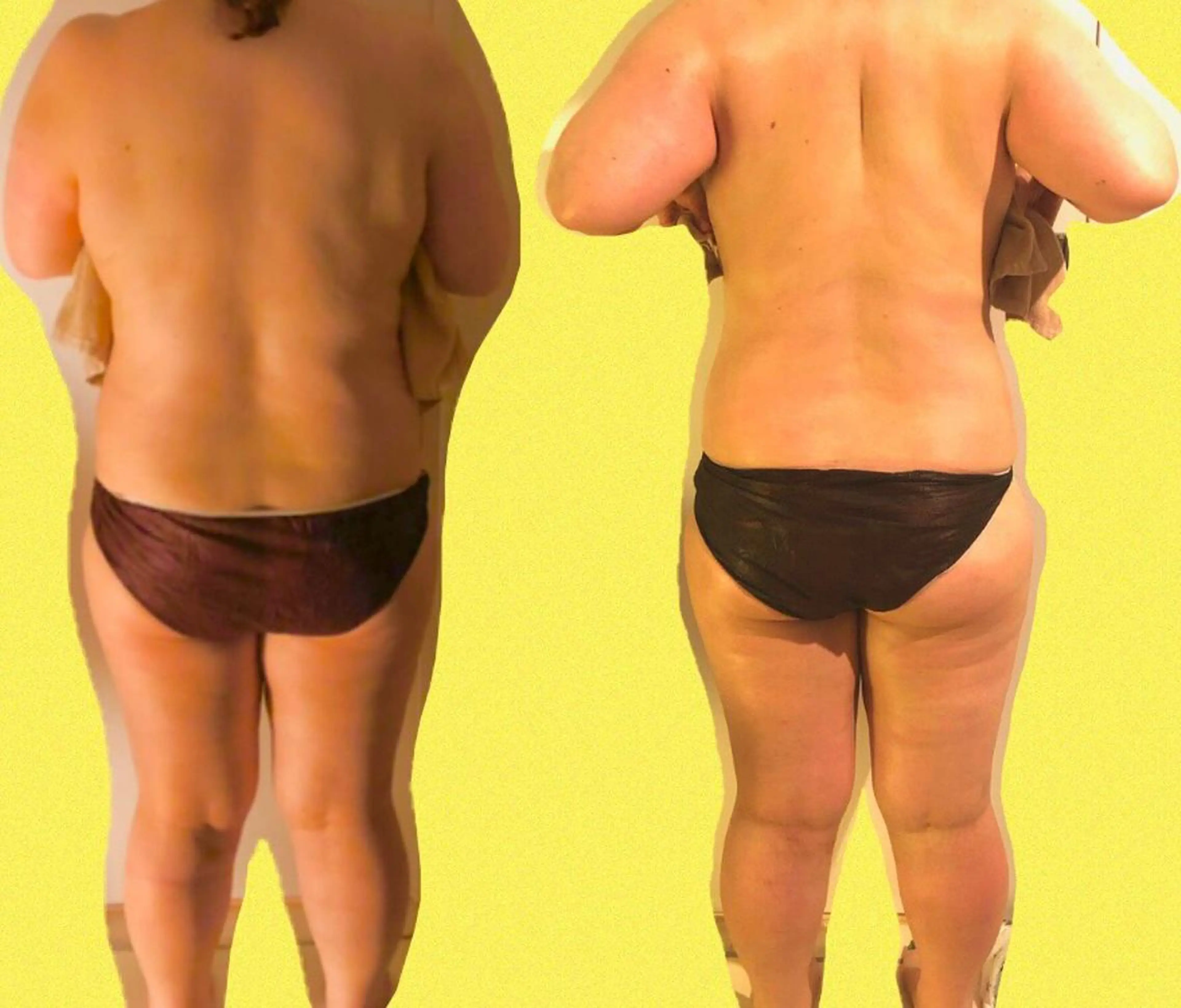 120分初回限定　全身たっぷり130分　3種のマシンと圧ハンドのデトックスエステの写真