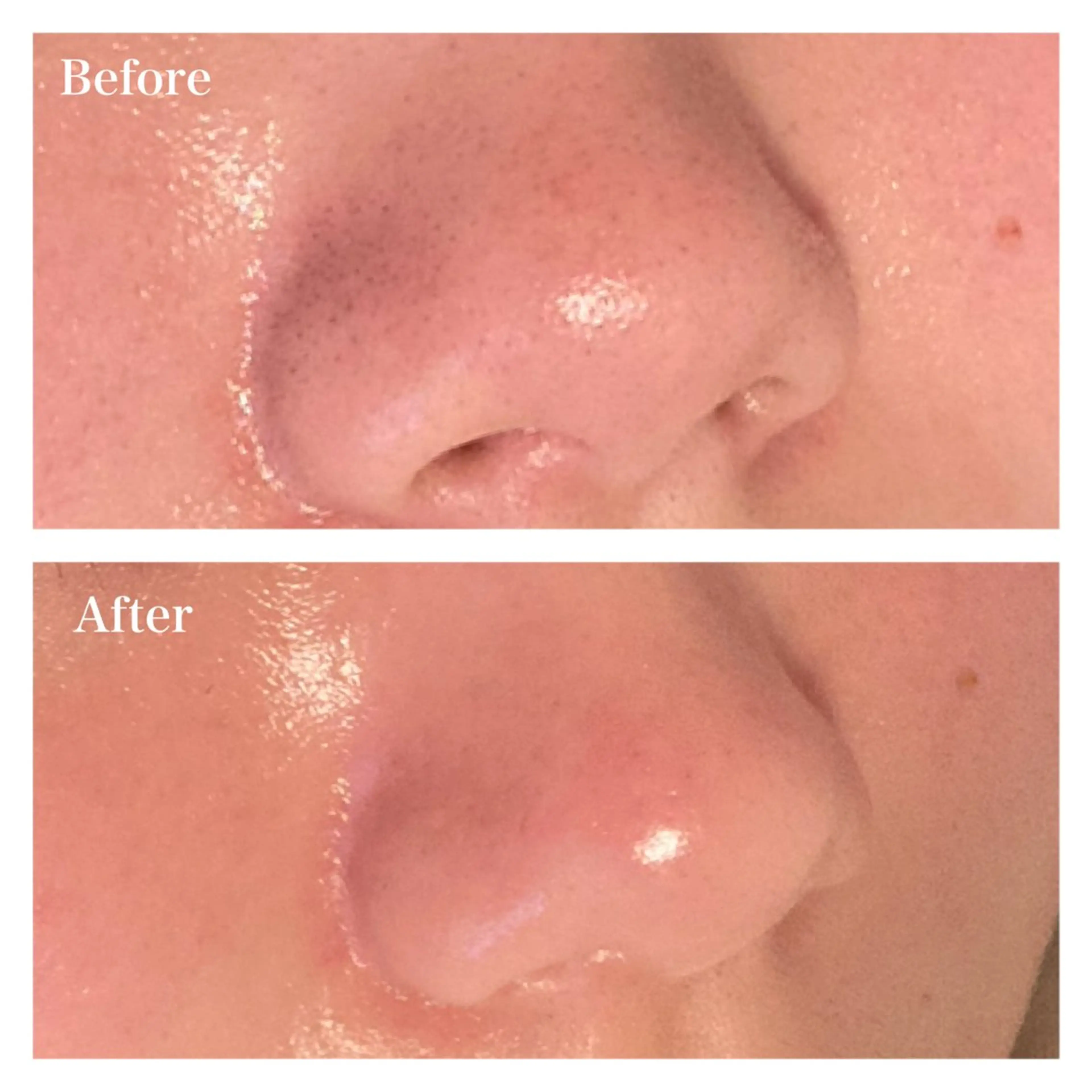 Ｂ&H所属・頭痛•肩こり専門/ 眉サロンB&H心斎橋のエステ・リラクイメージ