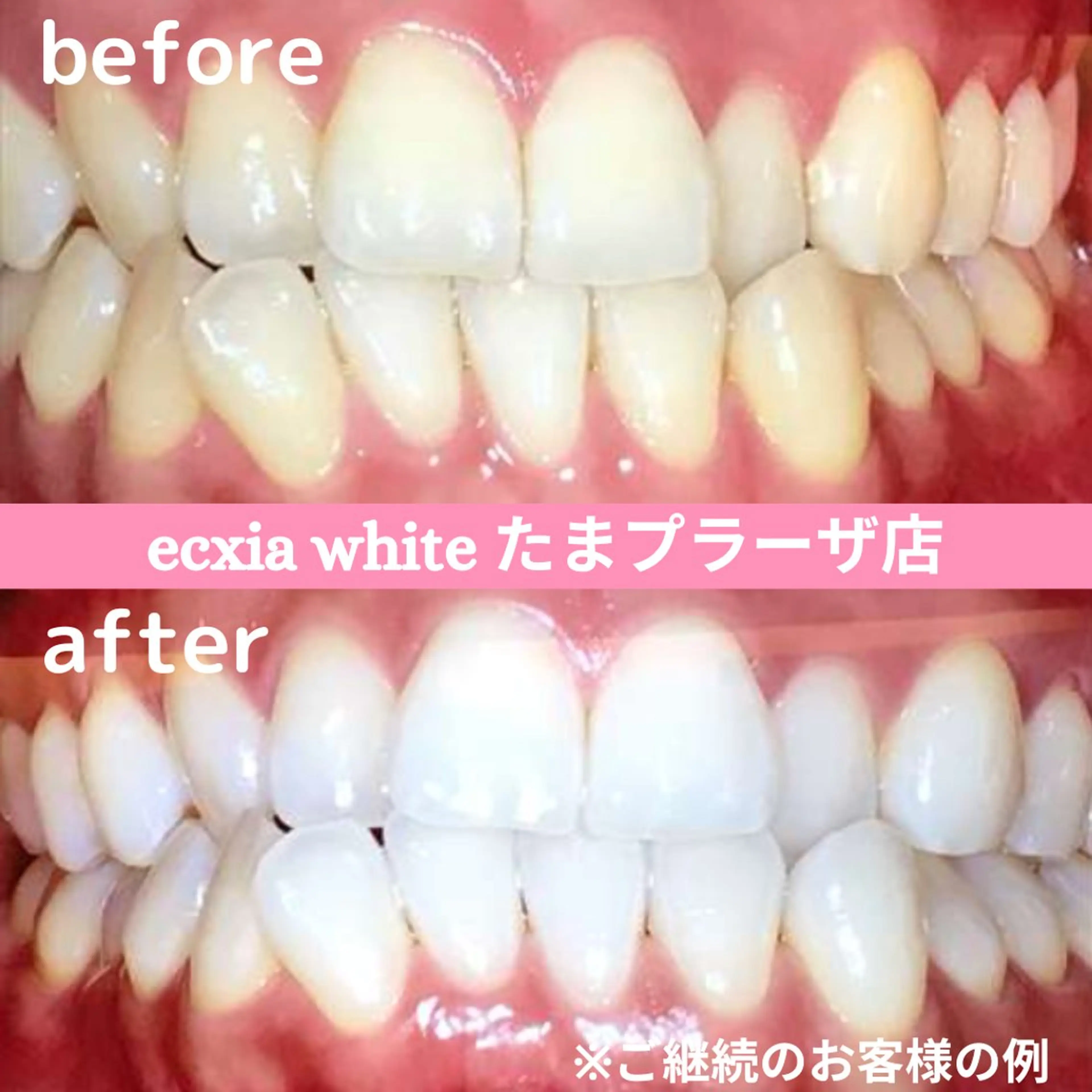 セルフホワイトニング　エクシアたまプラーザ店所属・セルフホワイトニング エクシアたまプラーザのその他イメージ