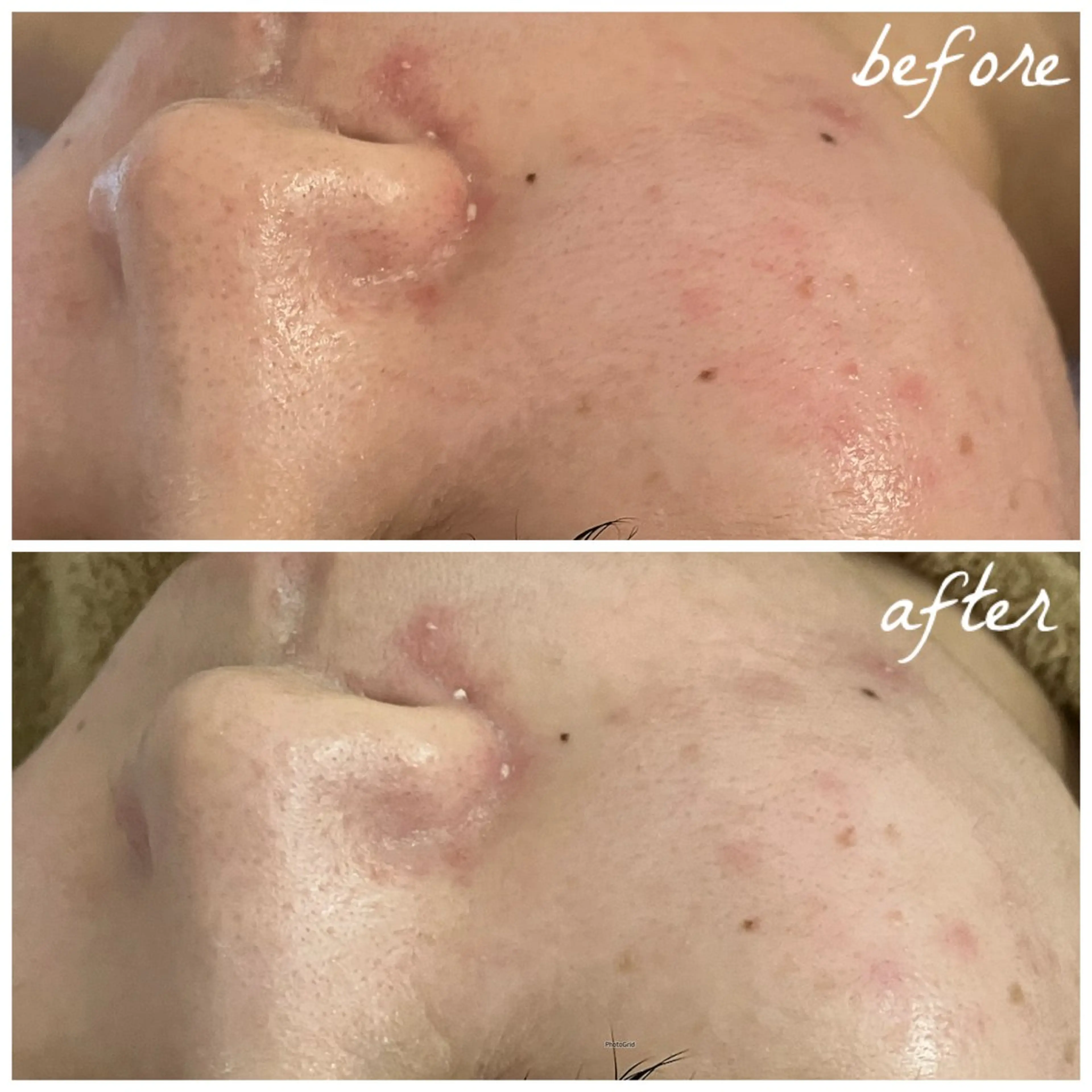 メンズ エステ メナード岐阜茜部 杉浦のエステ・リラクイメージ