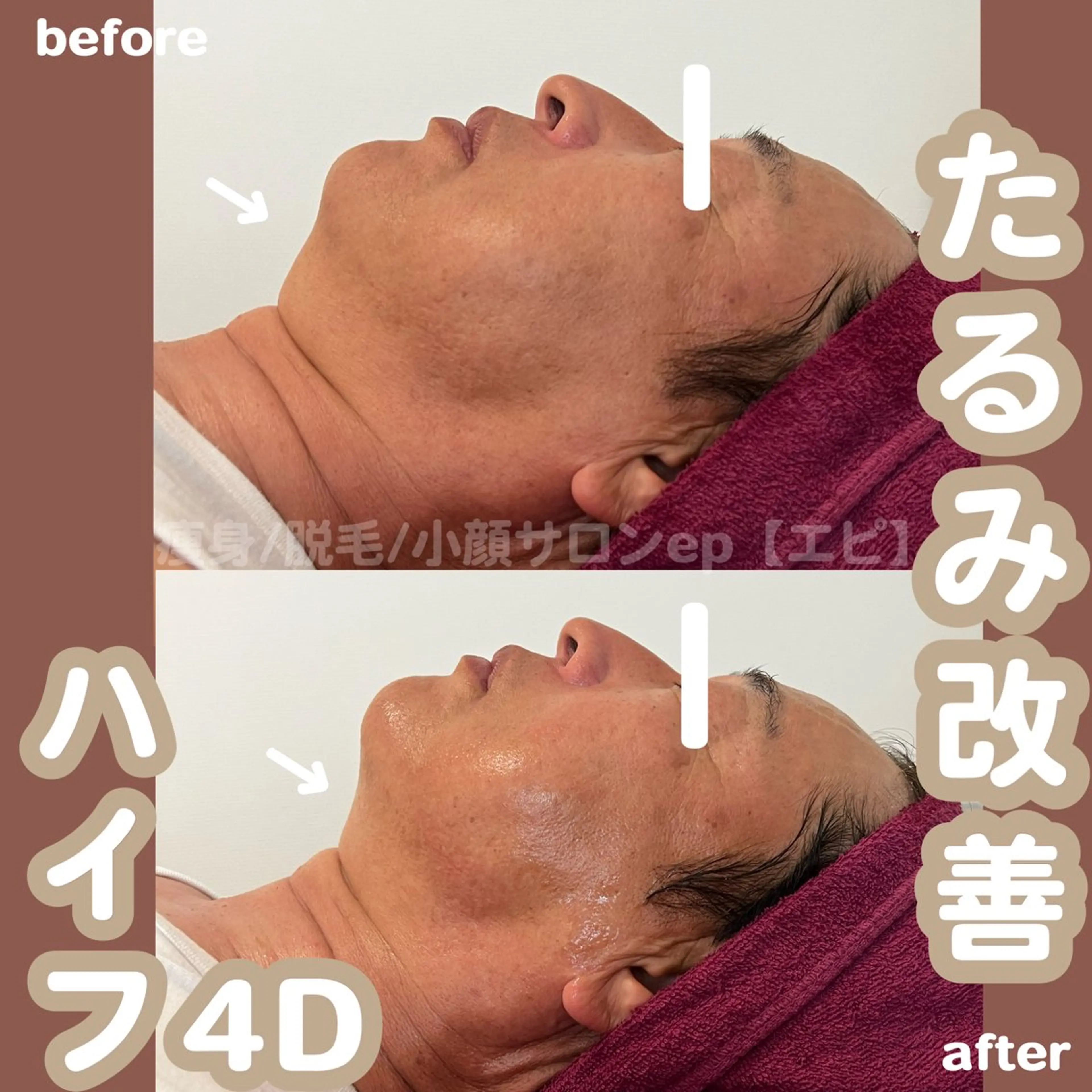 beauty salon epのエステ・リラクイメージ