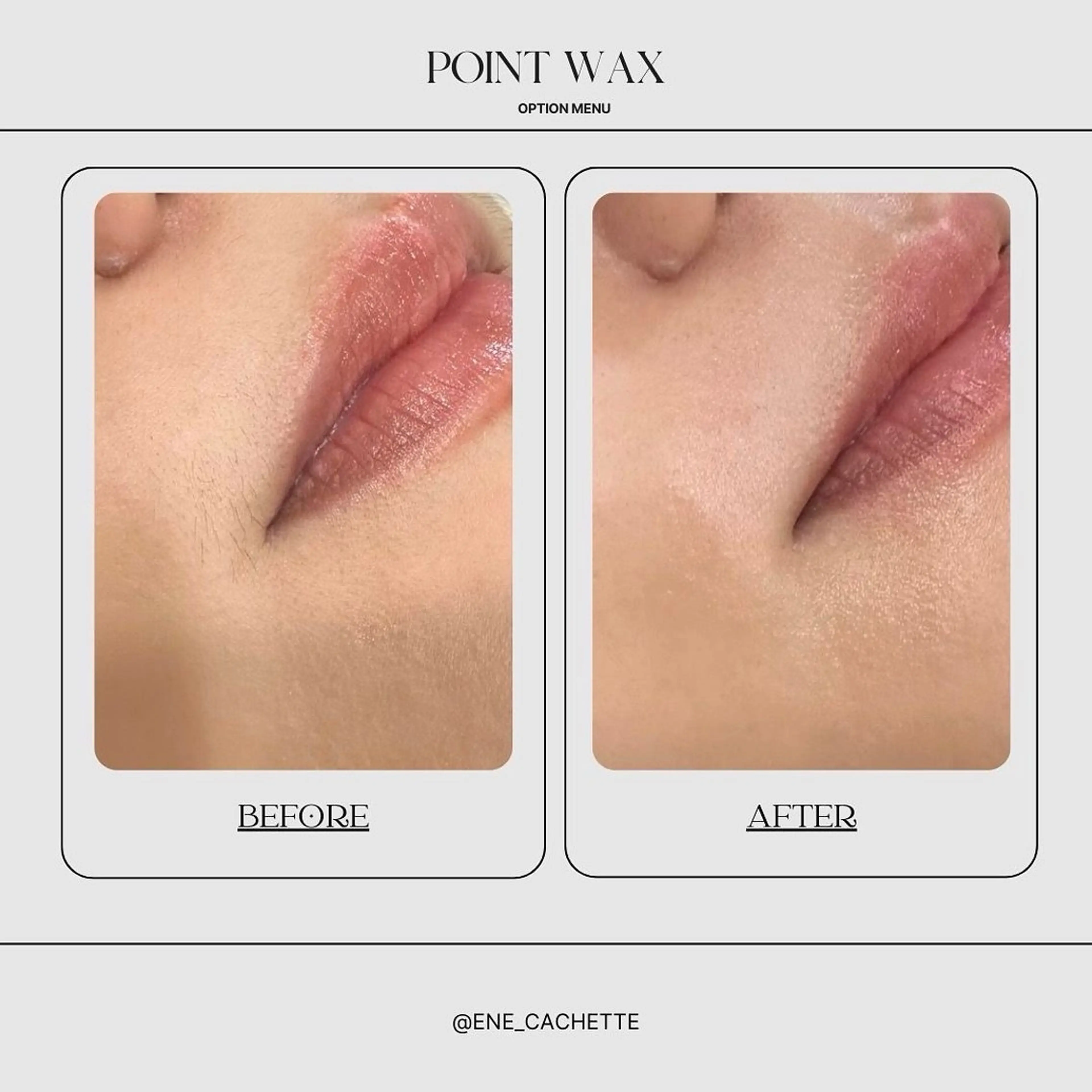 顔WAX脱毛1パーツの写真