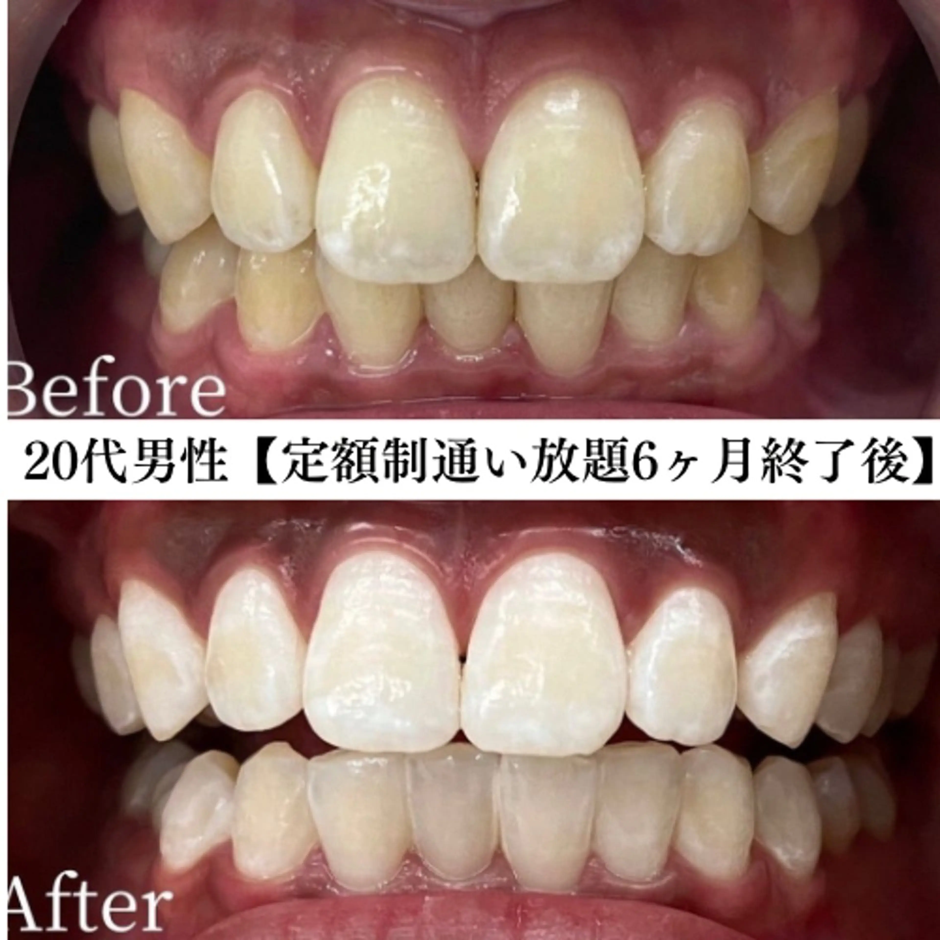 メンズ キッズ エステ リラク セルフホワイトニング専門店WHITE福岡天神店所属・セルフホワイト専門店 WHITE福岡天神店のエステ・リラクイメージ