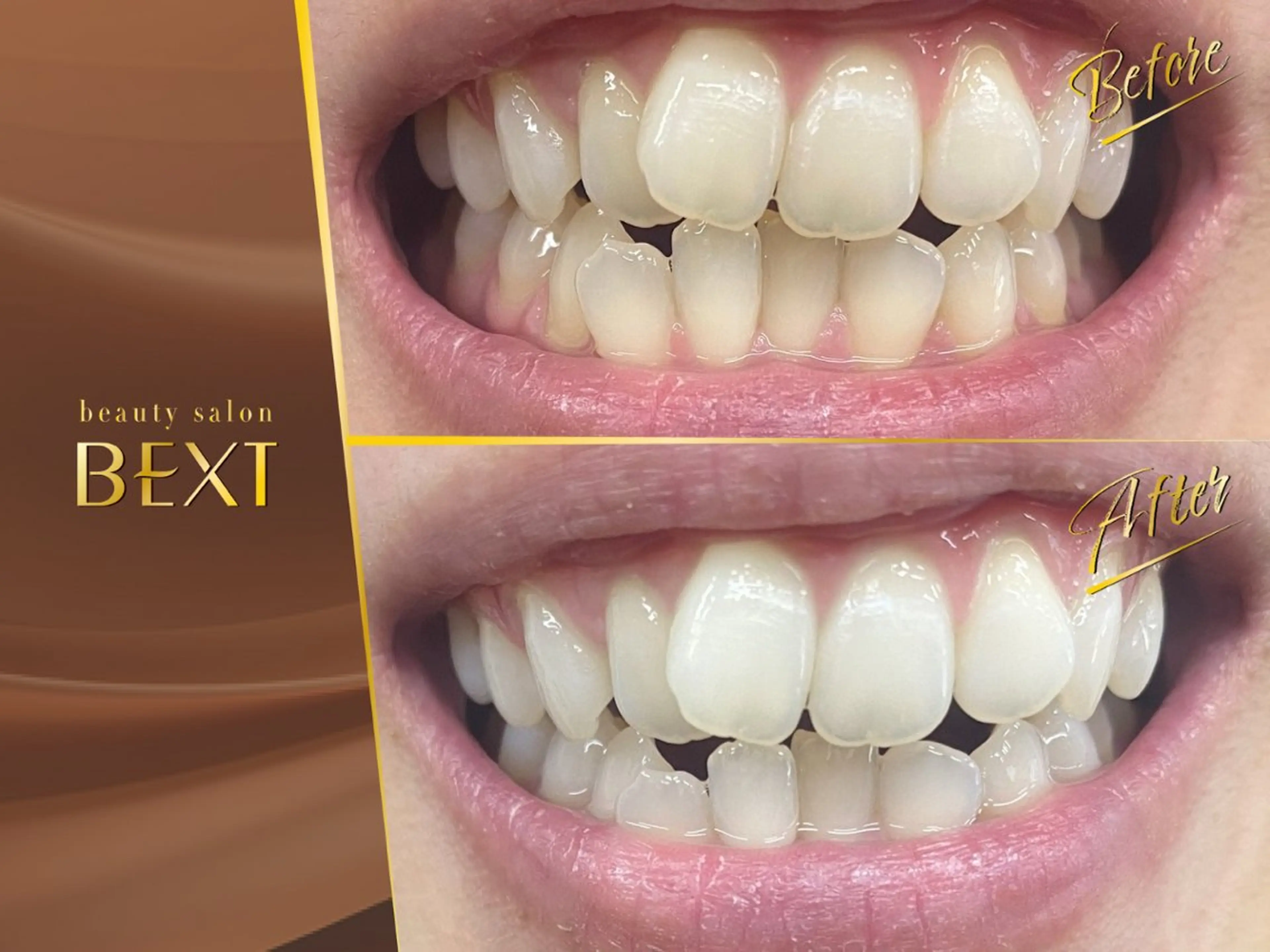 メンズ エステ リラク ビューティーサロンベクスト beautysalonBEXT所属・ビューティーサロン ベクスト名古屋のエステ・リラクイメージ