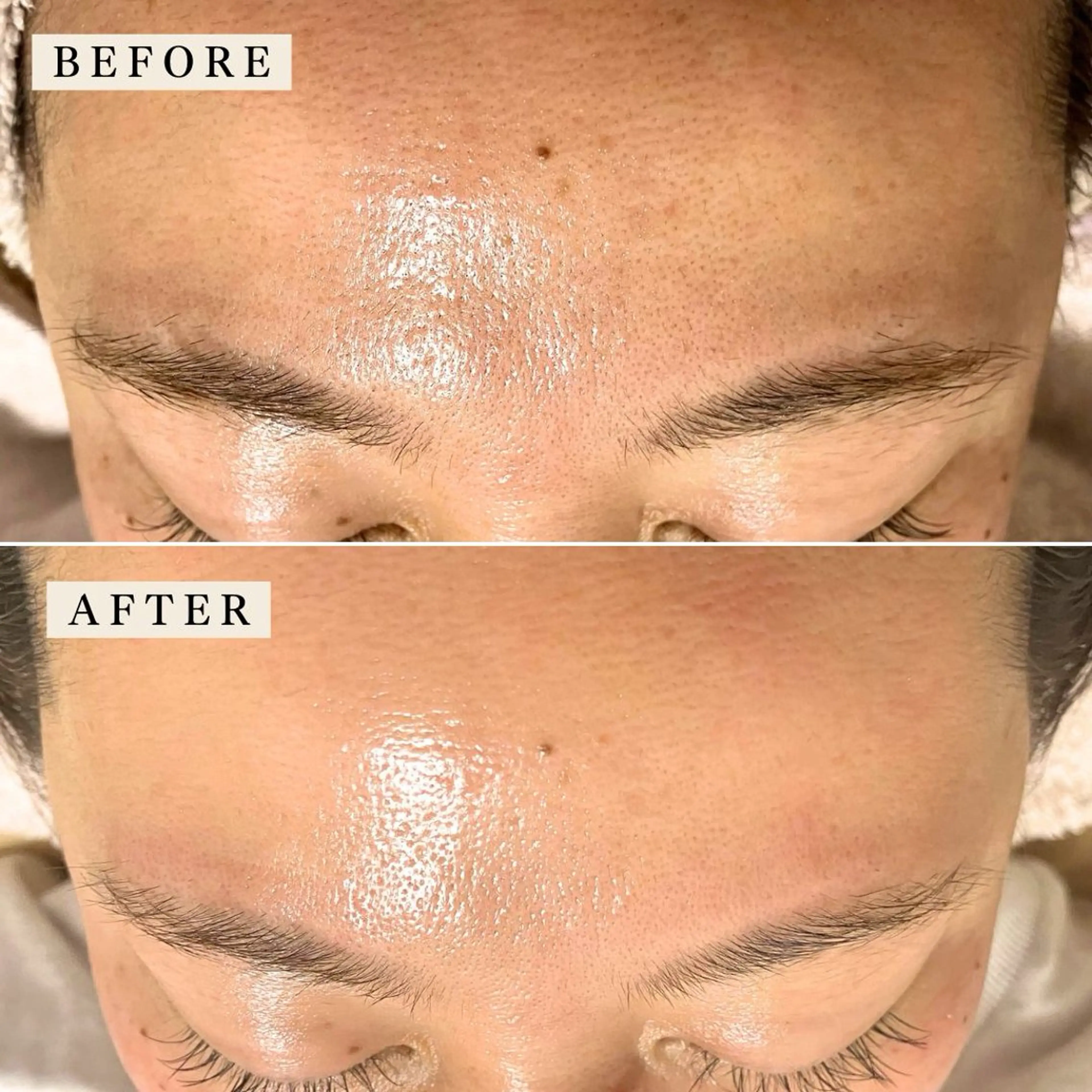 その他 【産毛・眉毛ケア＆肌質改善サロン】＊BiBi＊beautysalon所属・眉･産毛専門BiBi 糸脱毛スレッティングのエステ・リラクイメージ