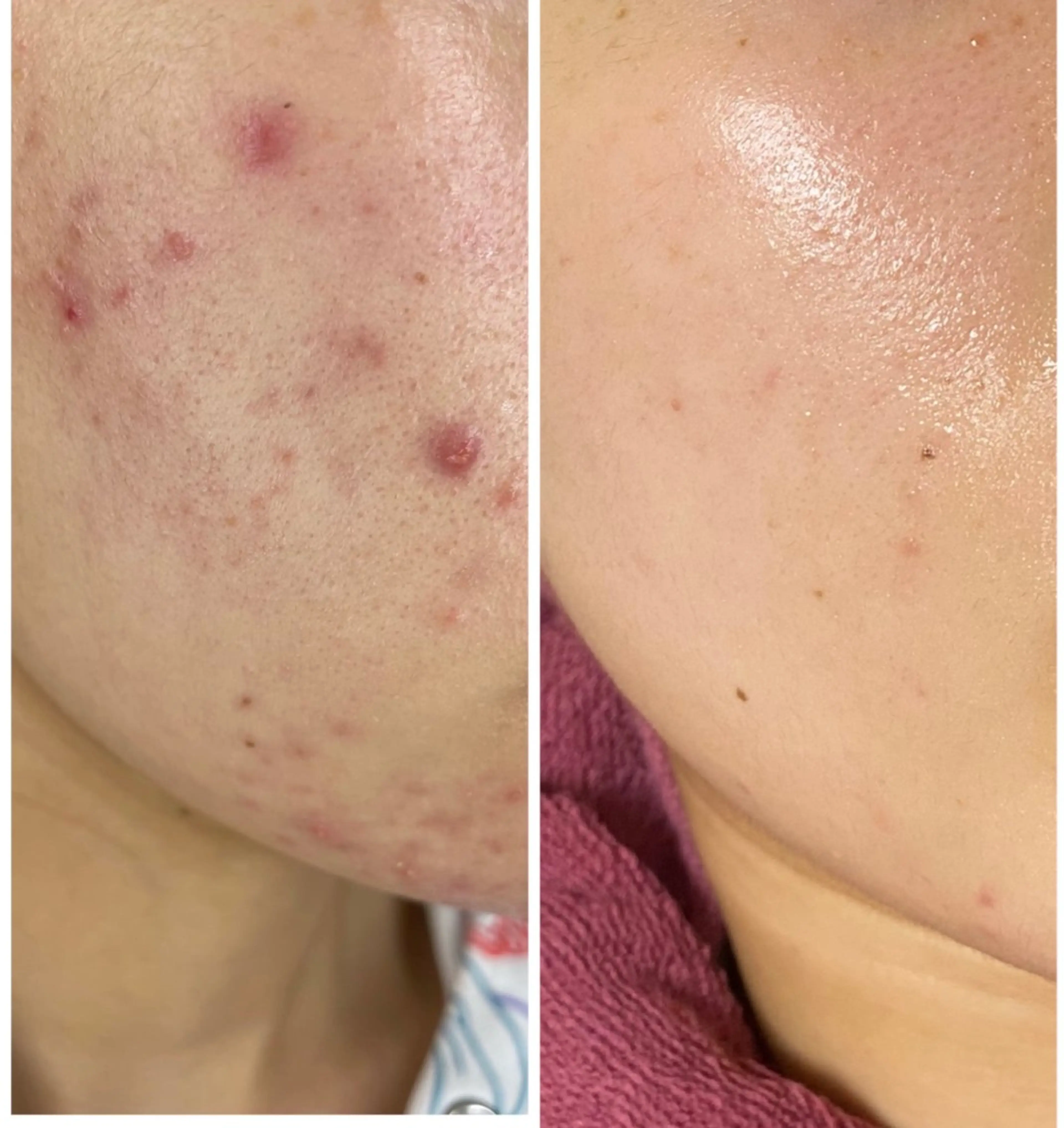 🏳️‍🌈 CHIYAKAのエステ・リラクイメージ