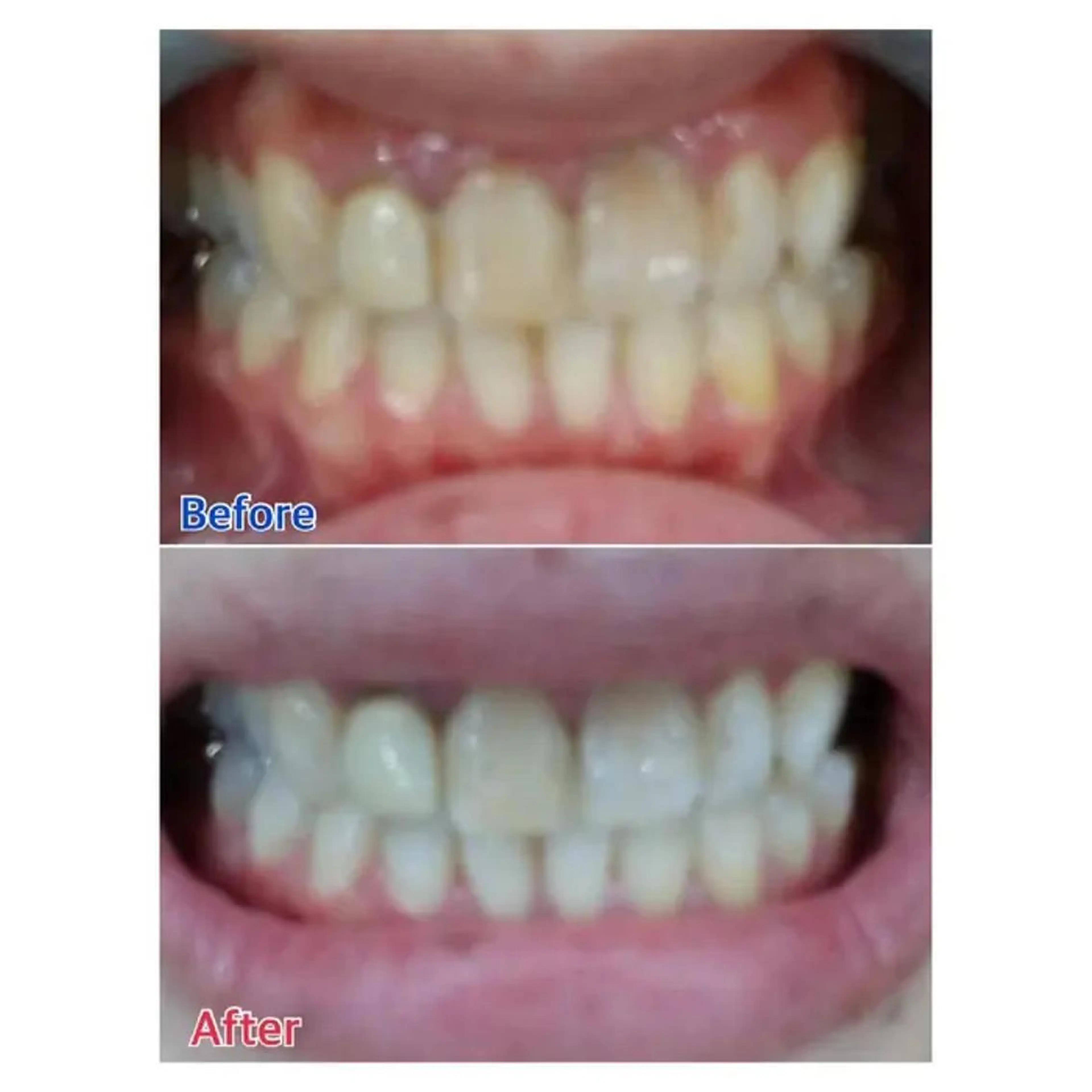 M渋谷店所属・M渋谷 ホワイトニングのエステ・リラクイメージ