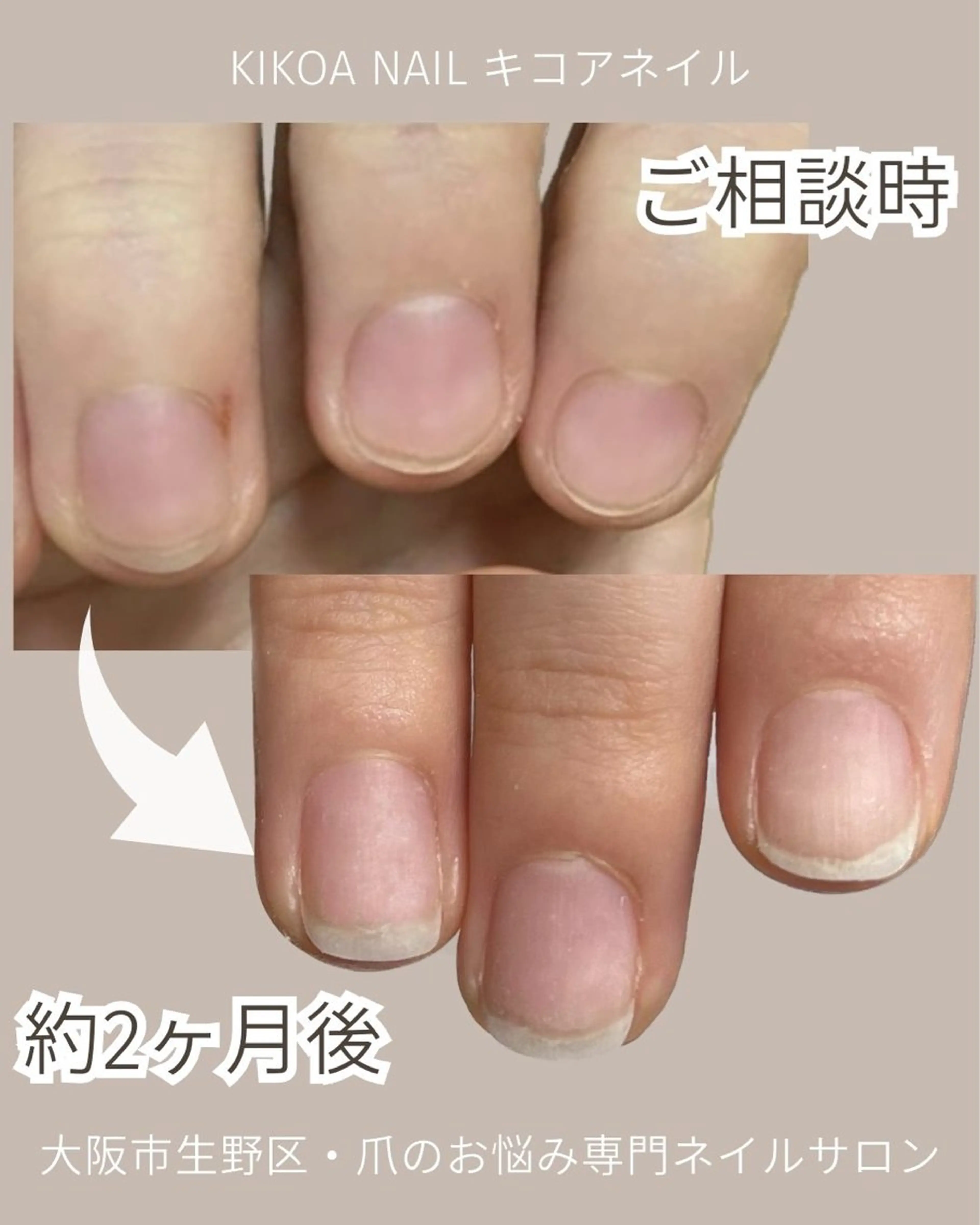 ネイル KIKOA NAIL キコアネイルのネイルデザイン
