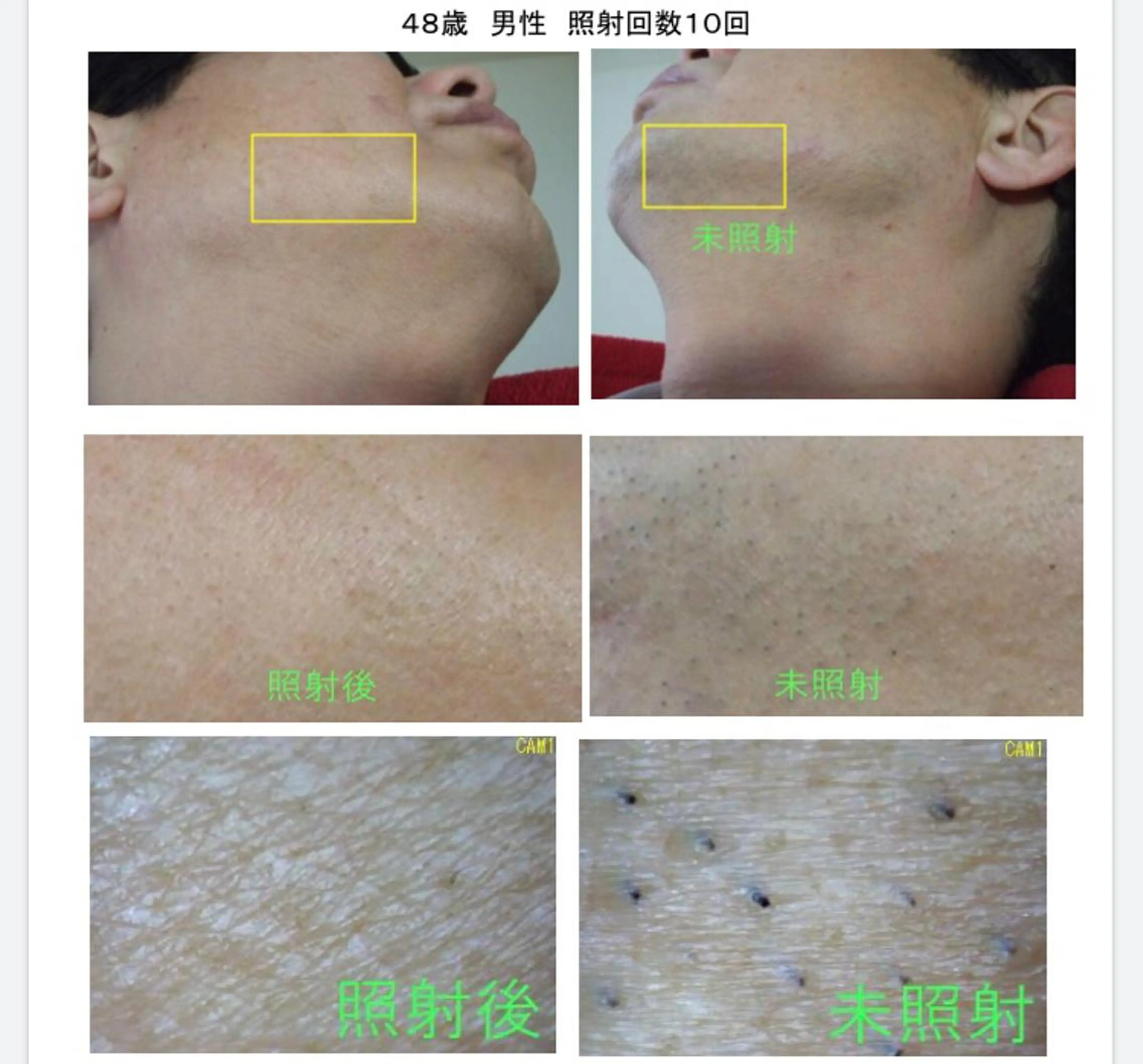 脱毛 セルフ脱毛&セルフエステ　onesalon  ワンサロン姫路所属・セルフ脱毛 One Salonのエステ・リラクイメージ