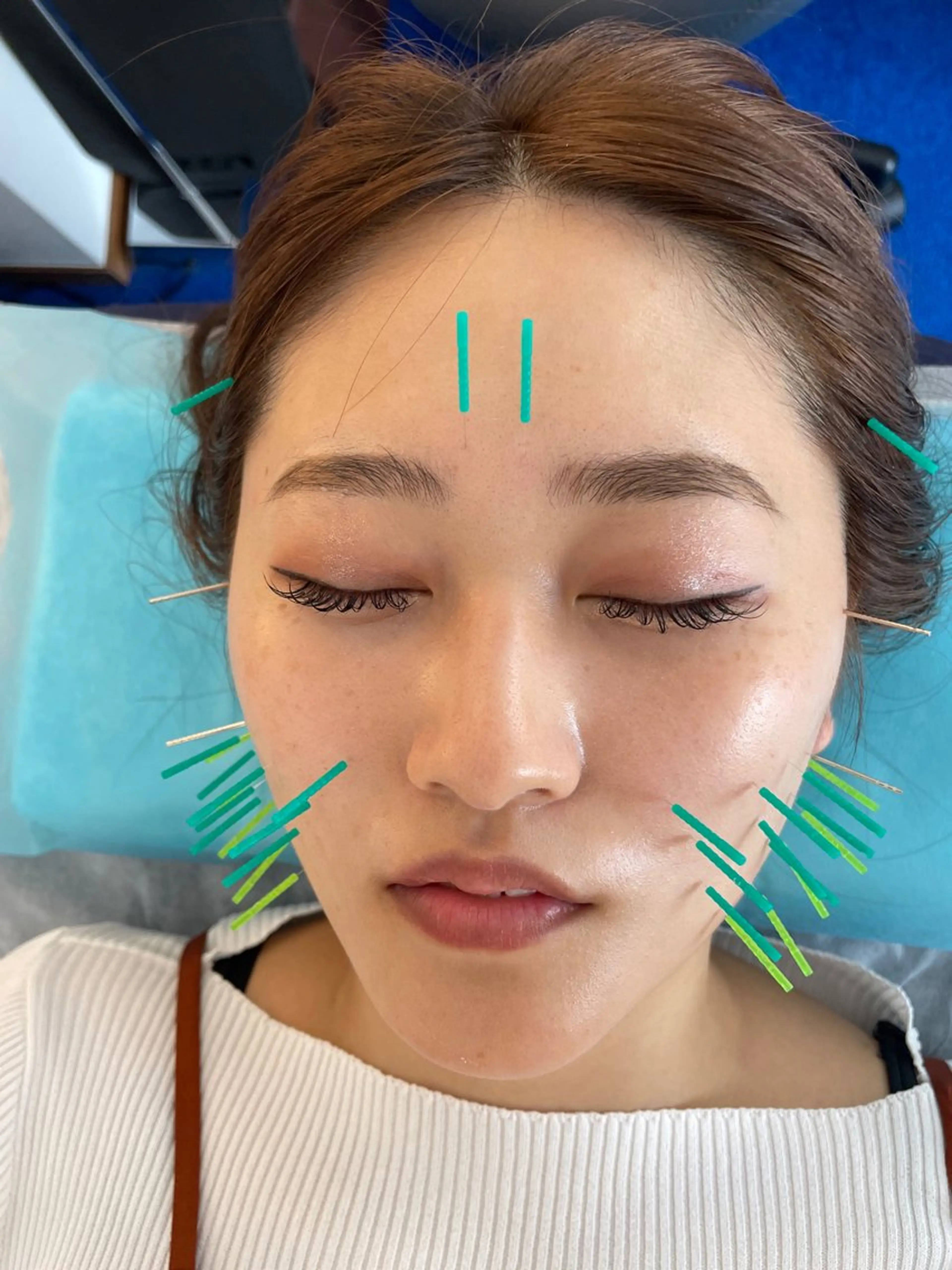 エステ リラク 小顔美容鍼専門サロン 渋谷YZのエステ・リラクイメージ