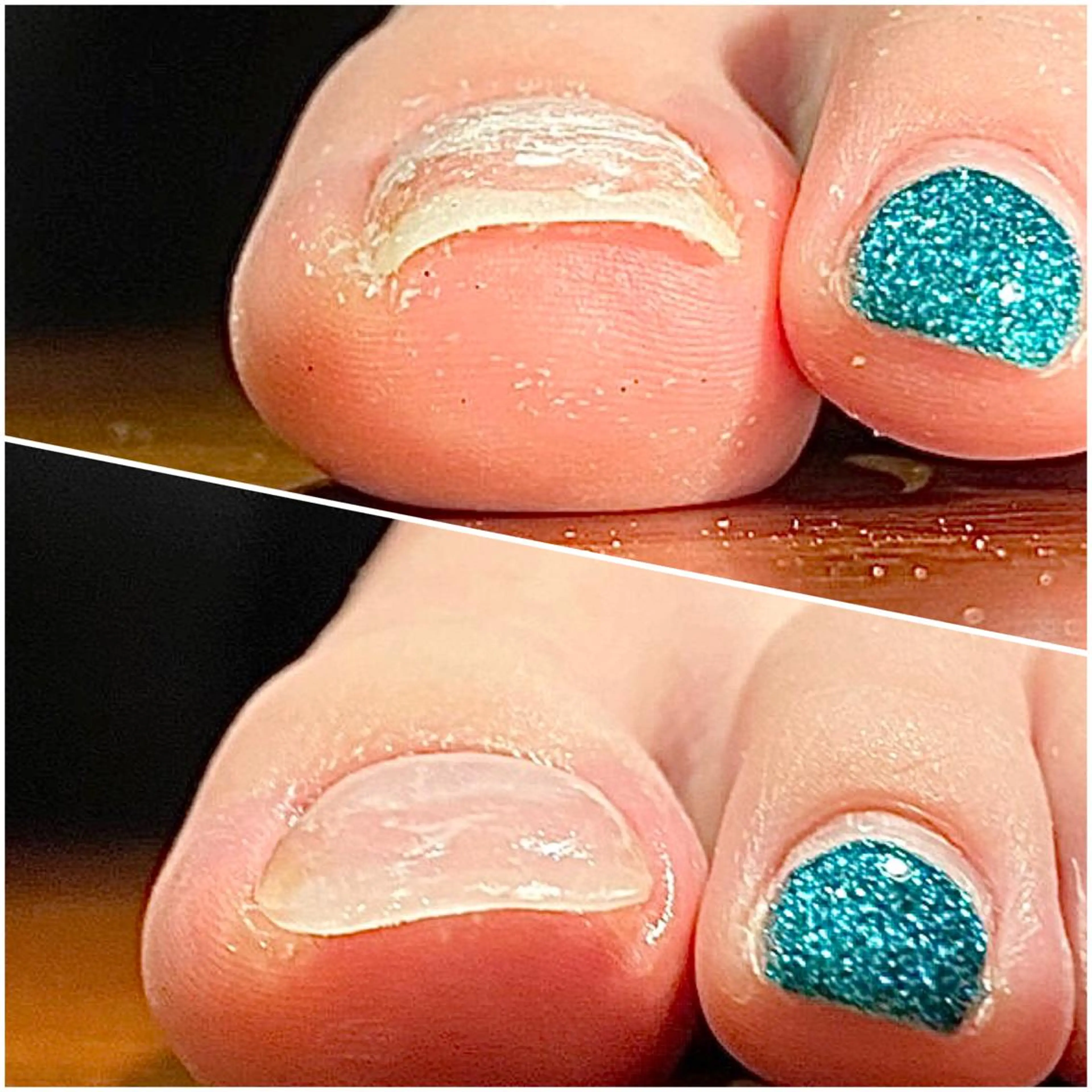 ネイル 深爪・巻き爪 専門サンセリテのネイルデザイン