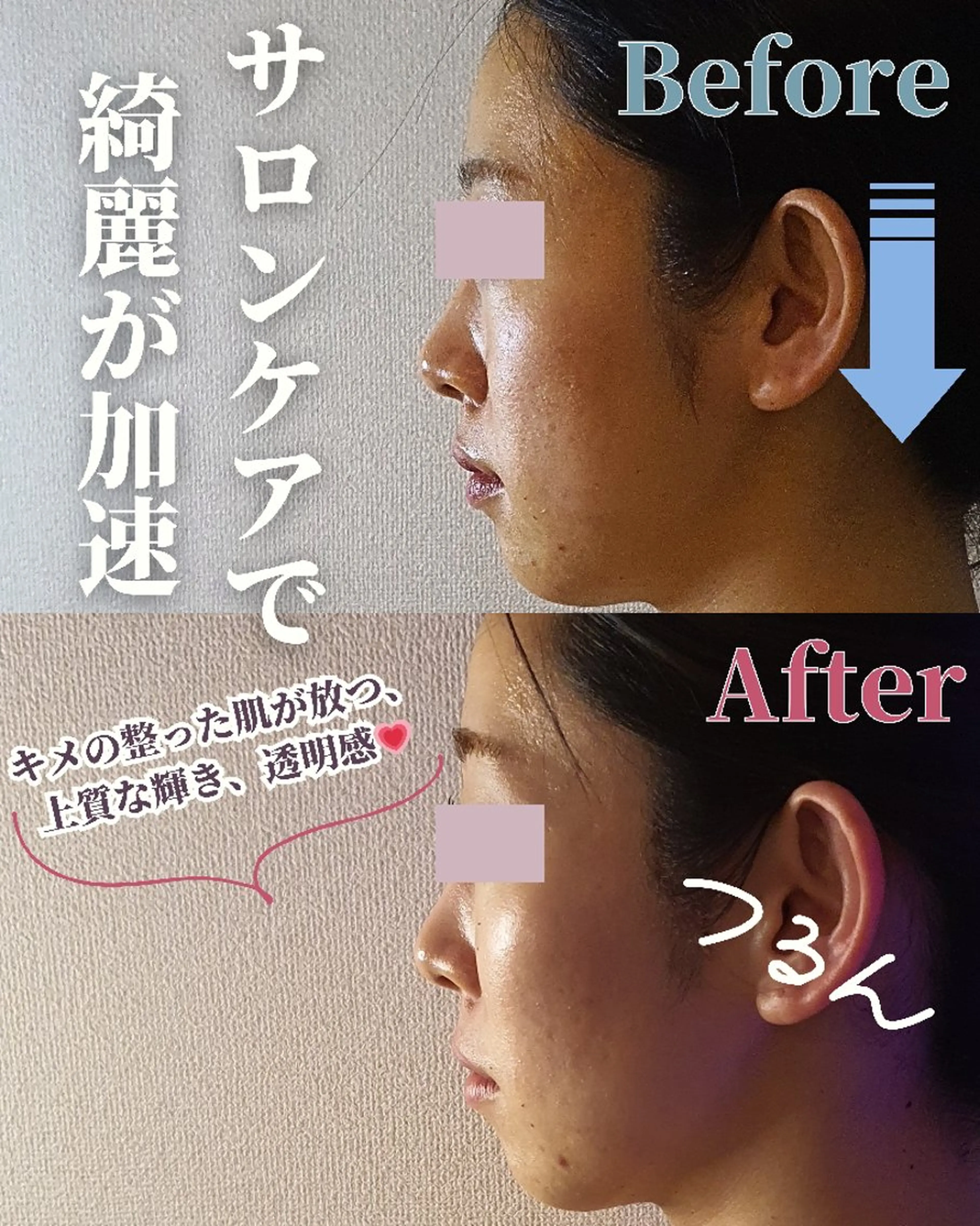 エステ リラク 痩身ハーブピーリング 筋膜リリース☆B&Hのエステ・リラクイメージ