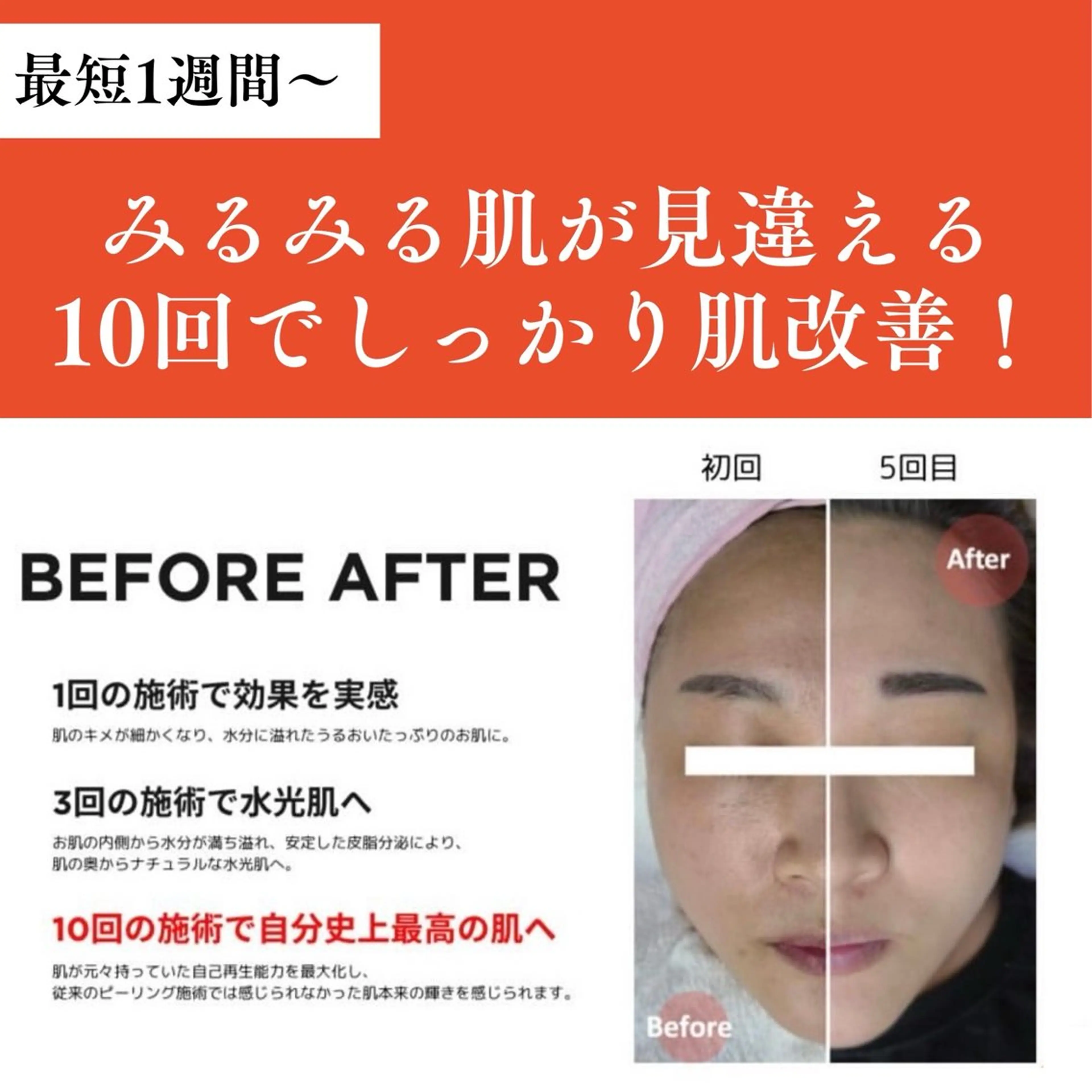 エステ 眉と肌の専門店　-STORY-所属・眉と肌の専門店 STORYのエステ・リラクイメージ