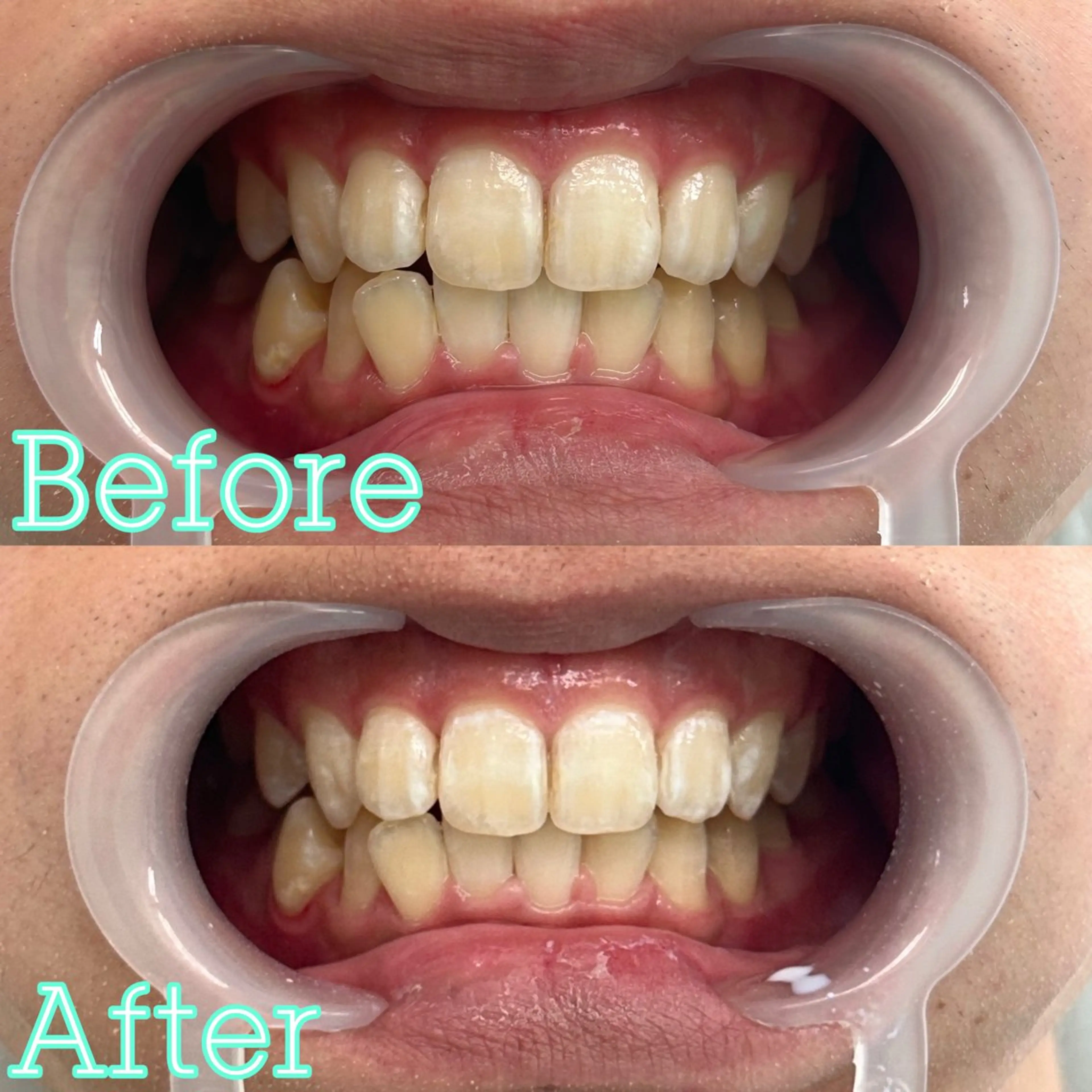 歯のホワイトニング専門店 MIGAQ 京都四条大宮店所属・佐藤 未来の眉毛・アイブロウイメージ